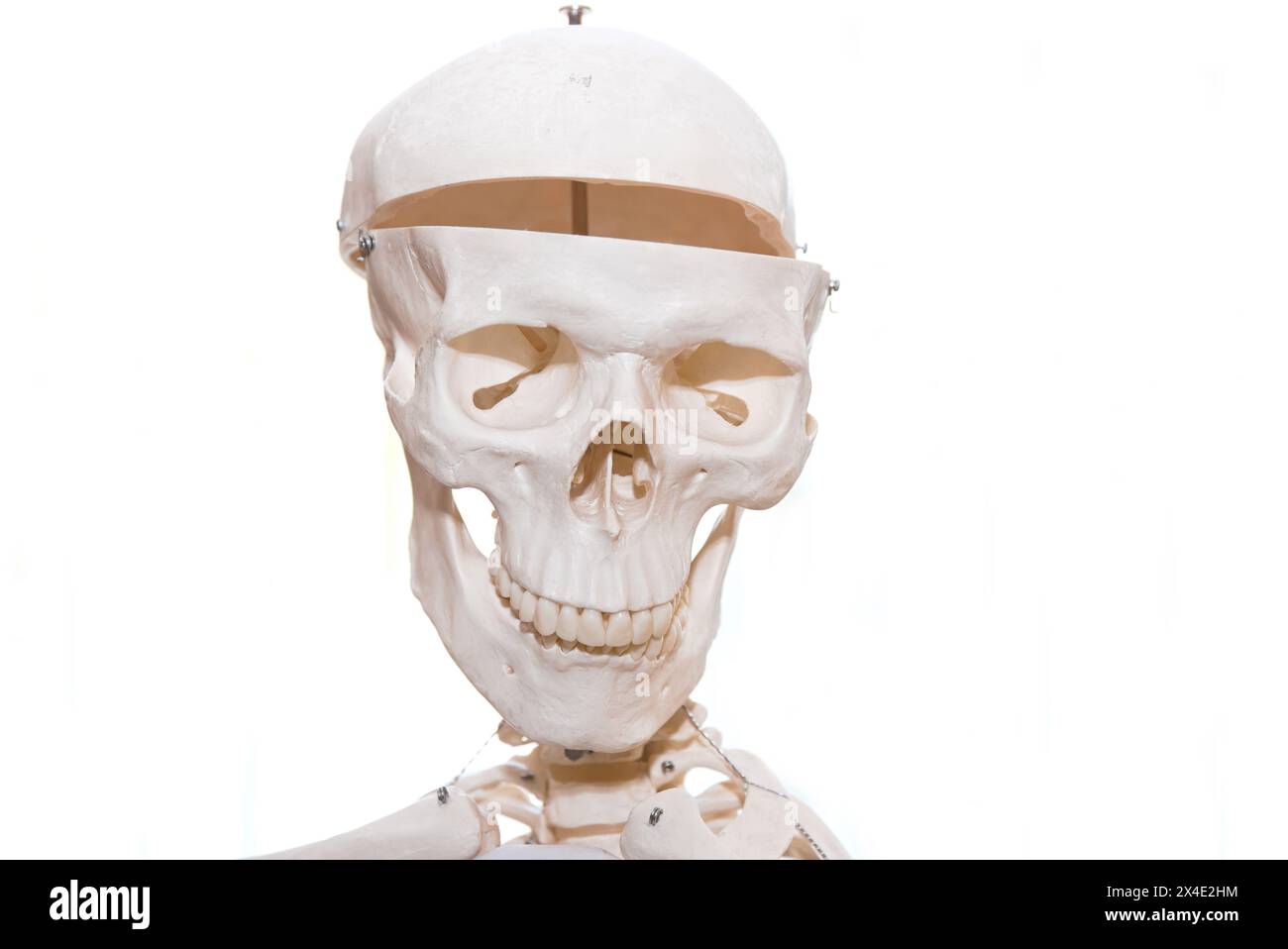 Knochen Eines Schädels – Skelett abgeschnitten und Text Freier Raum Stockfoto