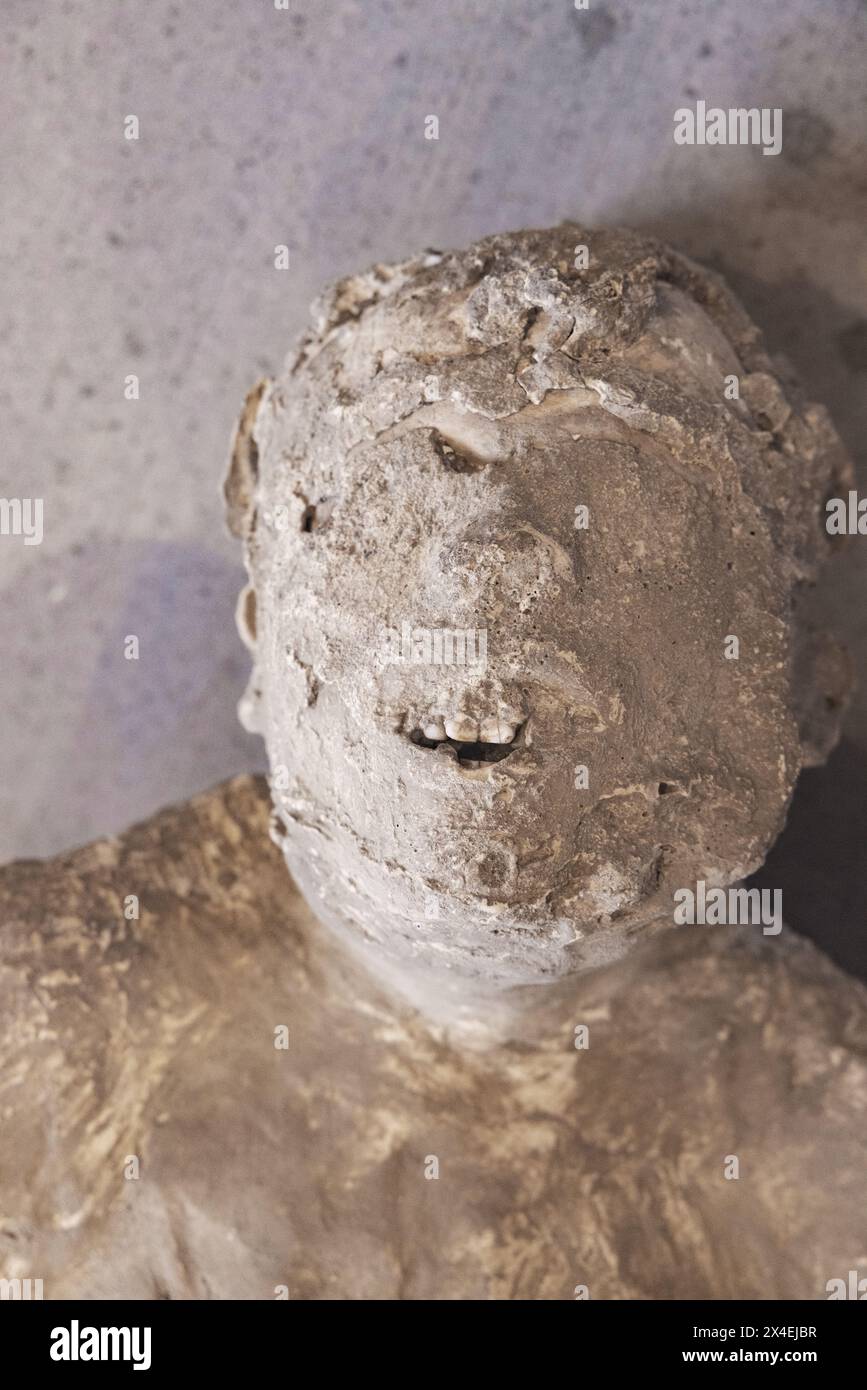 Pompeji Körper - Nahaufnahme eines Gesichts eines Mannes, der als Sklave gilt, das Antiquarium; Pompeji UNESCO-Weltkulturerbe, Italien Stockfoto
