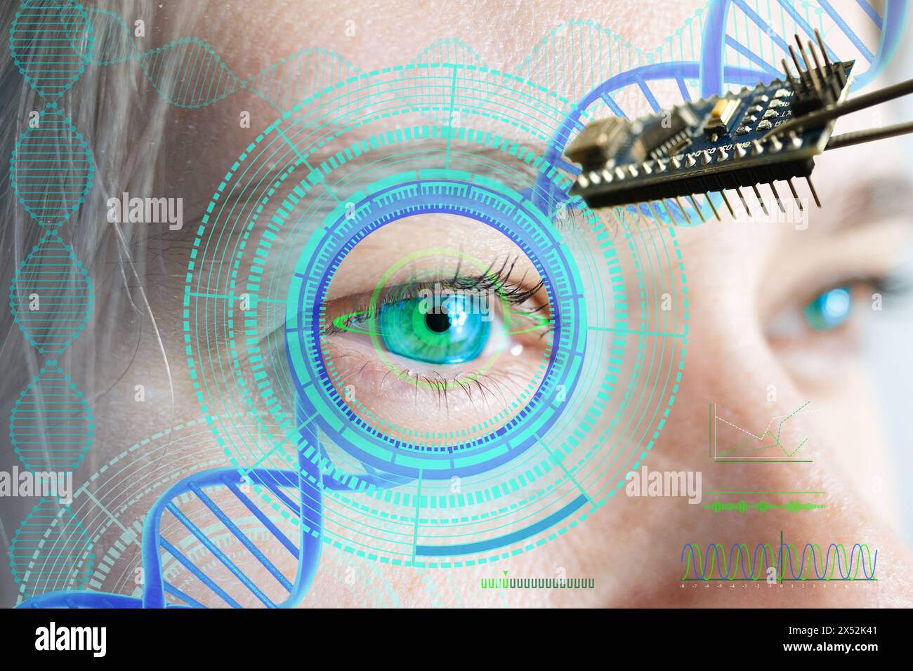 Installation eines elektronischen Chips in menschliches bionisches, neuroprothetisches Auge, modernste Technologie, visionärer technologischer Fortschritt, Wiederherstellung des Sehvermögens Stockfoto