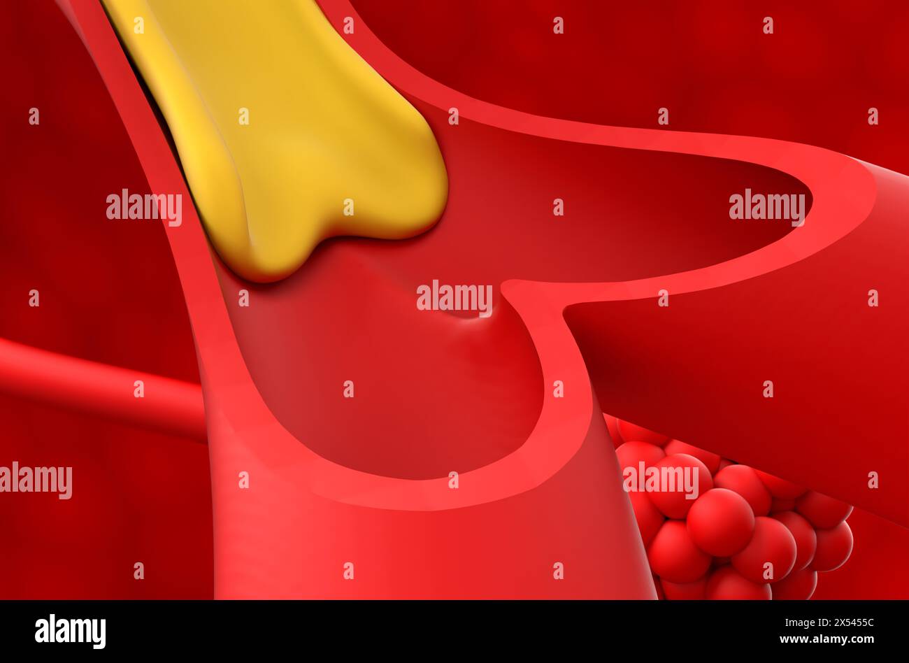 Zystische Fibrose (CF) – Nahaufnahme 3D-Illustration Stockfoto