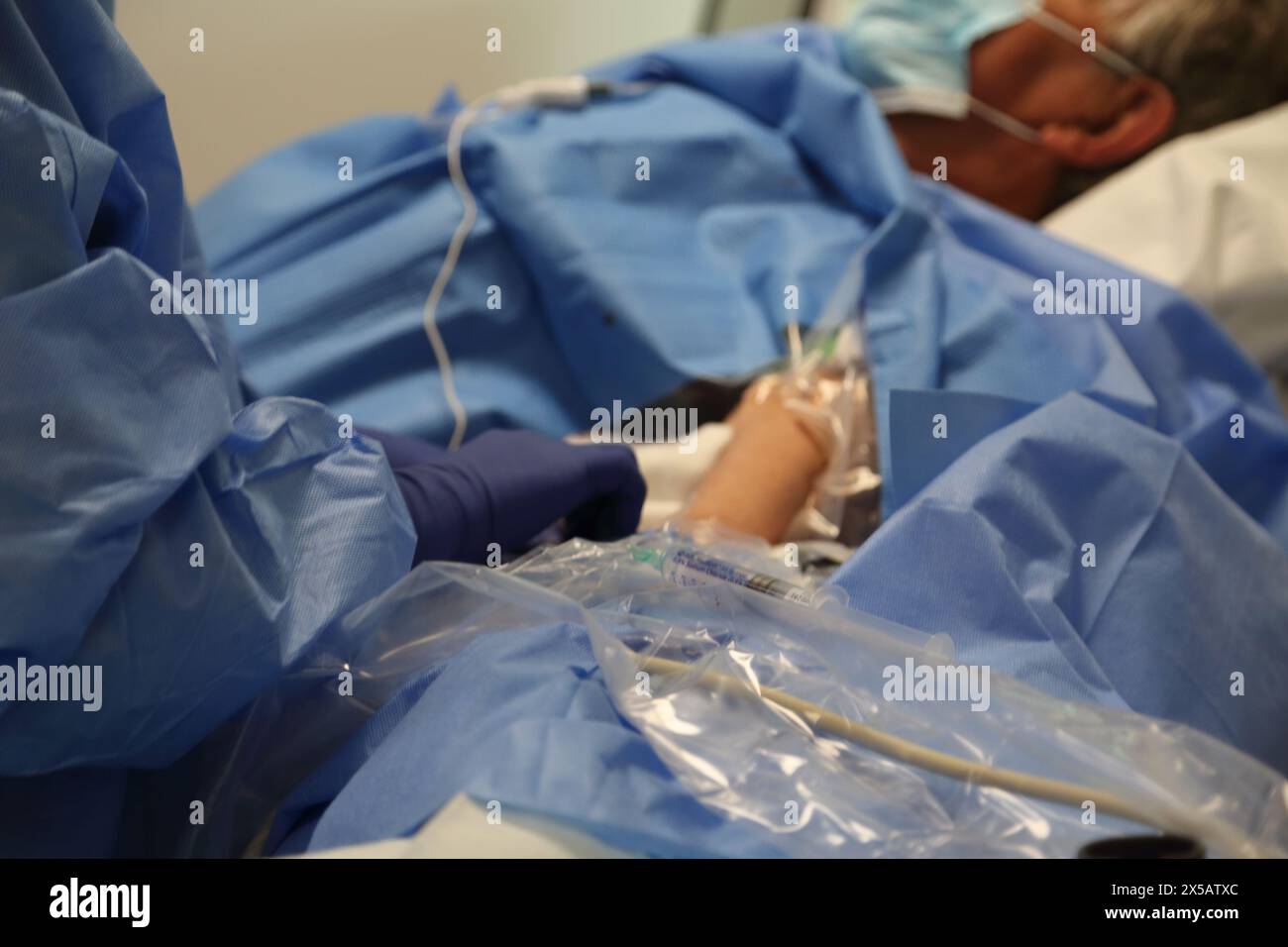 Patient mit peripher eingesetztem Zentralkatheter (Picc Line) unter Lokalanästhesie im Hospital Surrey England Stockfoto