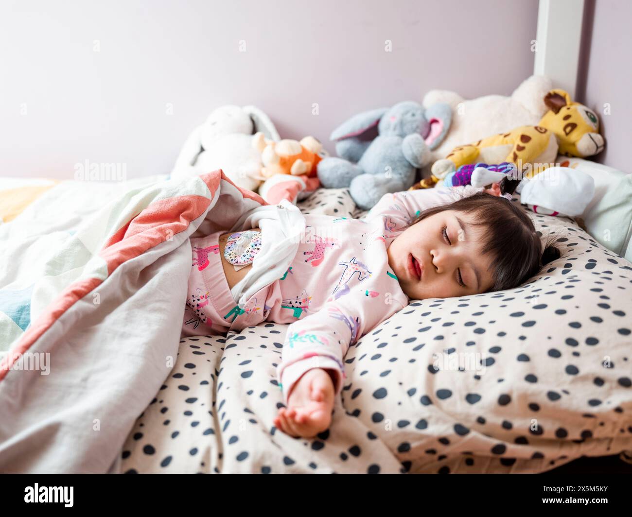 Mädchen mit Down-Syndrom schläft im Bett Stockfoto
