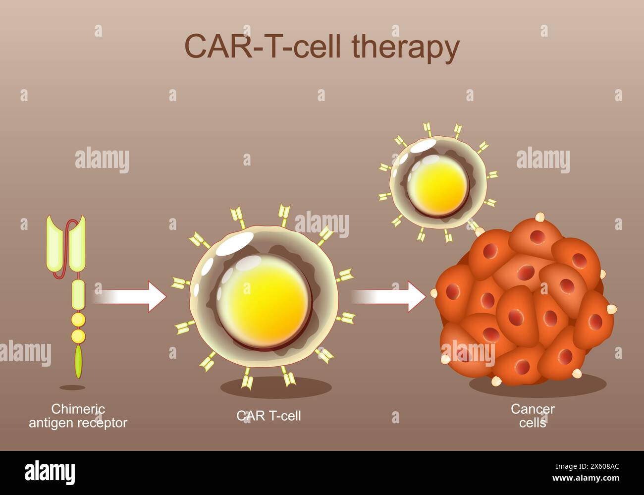 CAR-T-Zelltherapie. Krebsimmuntherapie. Chimärer Antigenrezeptor. Gentechnik. Personalisierte Medizin. Tumor Targeting. Vektorabbildung. Stock Vektor