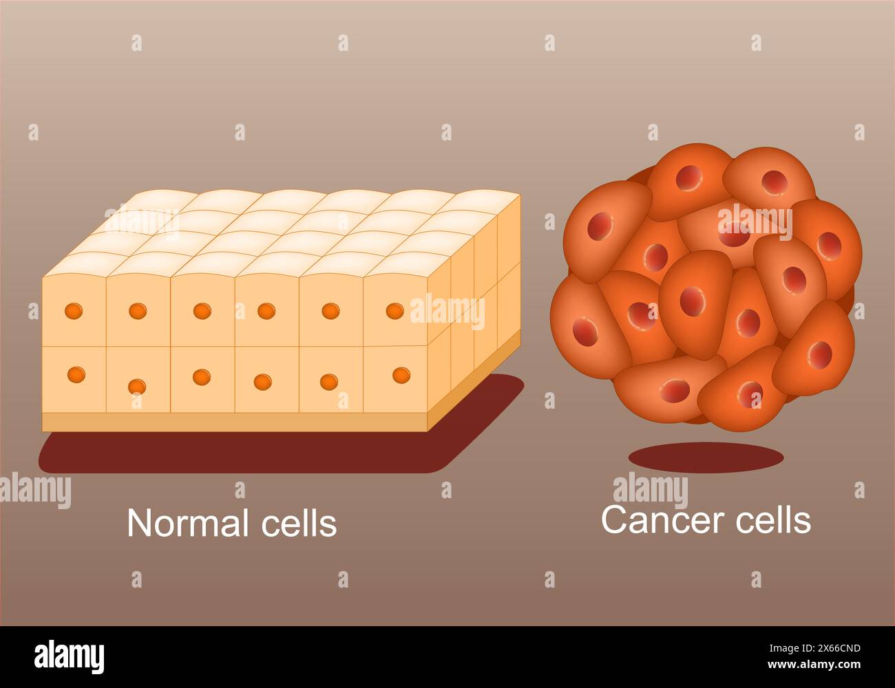 Krebs. Der Unterschied zwischen gesundem Gewebe und malignem Tumor. Nahaufnahme normaler Zellen und Krebszellen. Vektorposter. Abbildung „Isometrische Abwicklung“. Stock Vektor