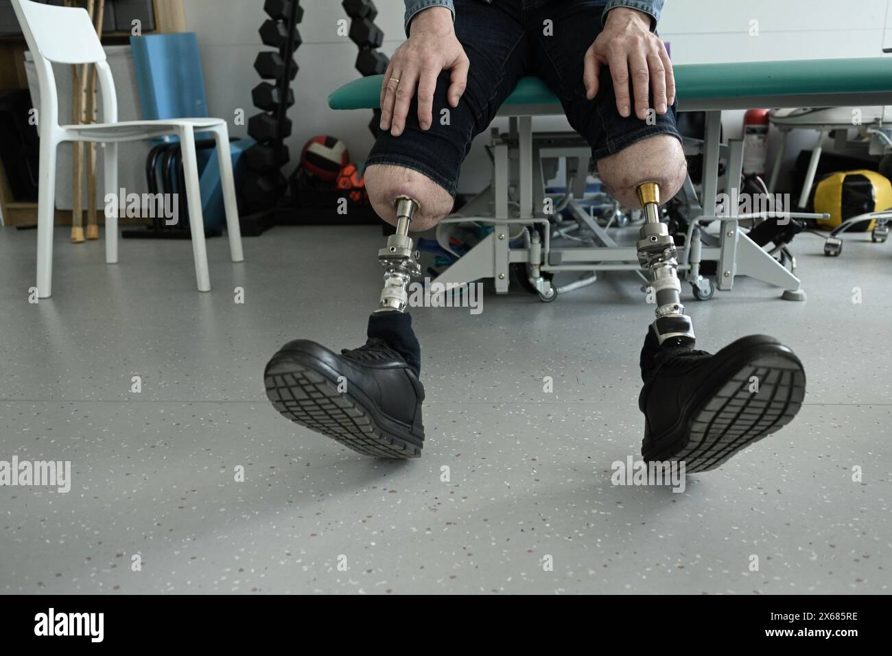 Ein Mann mit Knochen-implantierten Beinprothesen. Osteointegration Stockfoto