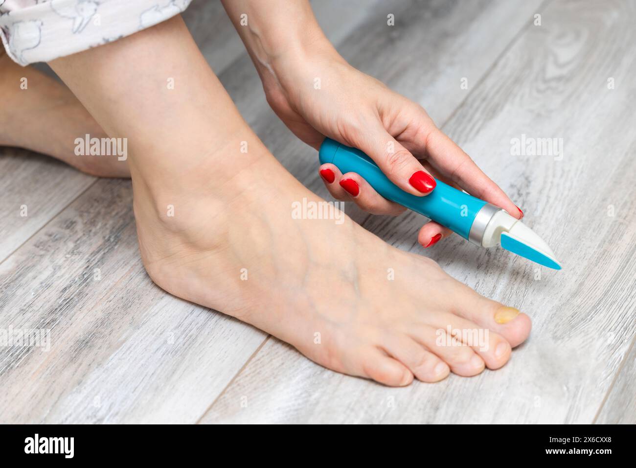 Eine Frau schleift ihre Zehennägel mit einem Schleifgerät. Nagelpilz. Zehennagel-Krankheit. Frau, die sich um die Zehennägel kümmert. Gelber Zehennagel. Elektrischer Nagelschleifer. Stockfoto