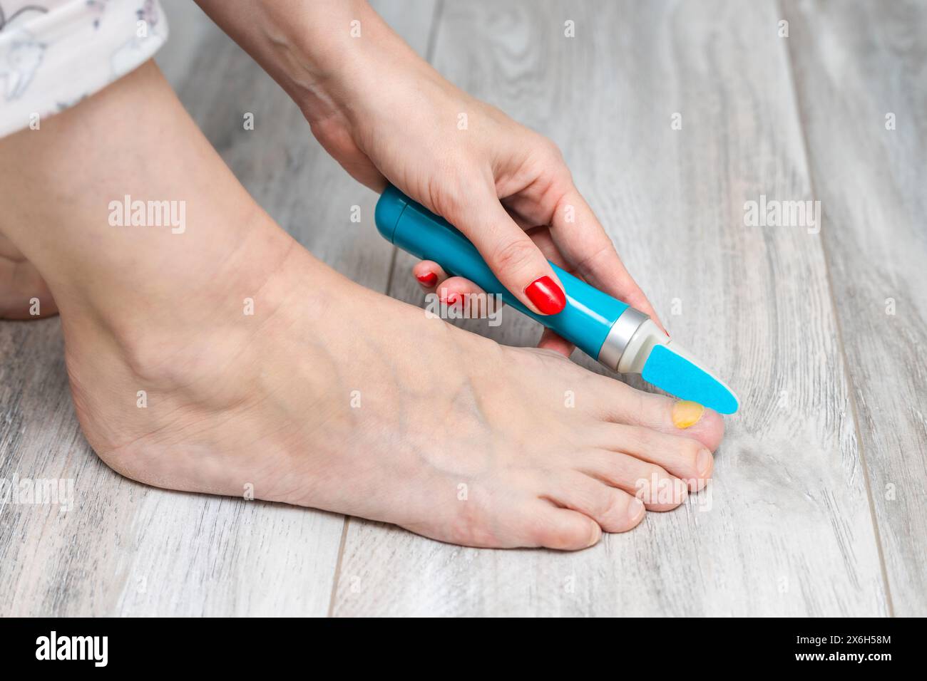 Eine Frau schleift ihre Zehennägel mit einem Schleifgerät. Nagelpilz. Zehennagel-Krankheit. Frau, die sich um die Zehennägel kümmert. Gelber Zehennagel. Elektrischer Nagelschleifer. Fürsorglich f Stockfoto