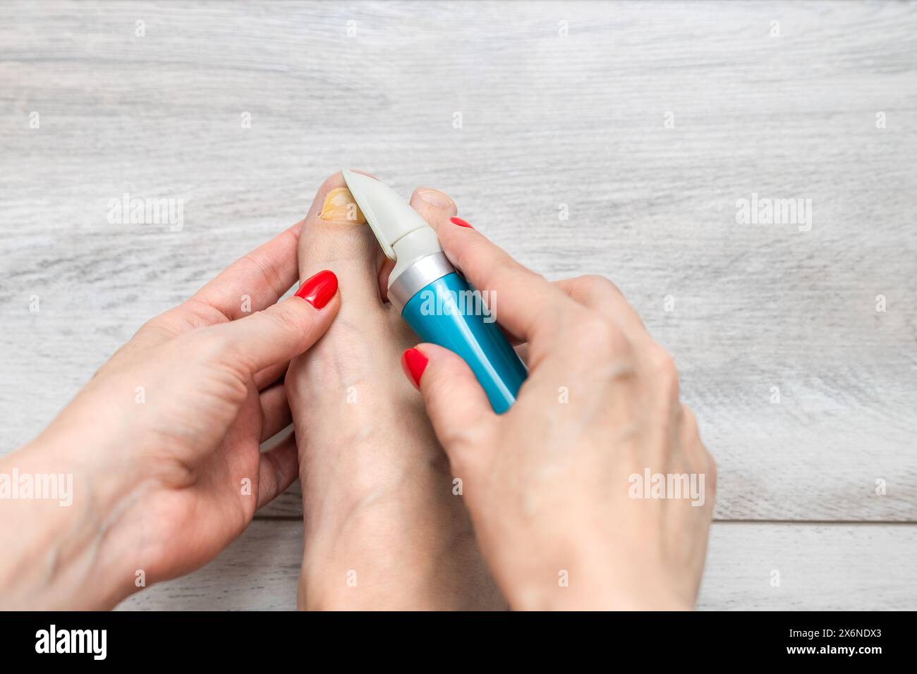 Eine Frau schleift ihre Zehennägel mit einem Schleifgerät. Nagelpilz. Zehennagel-Krankheit. Frau, die sich um die Zehennägel kümmert. Gelber Zehennagel. Elektrischer Nagelschleifer. Fürsorglich f Stockfoto