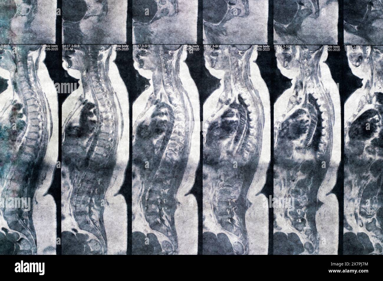 Magnetcomputertomographisches Foto von Frauen Stockfoto