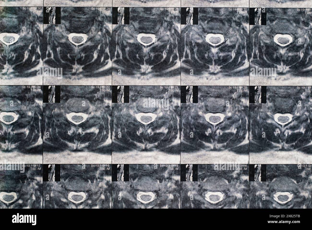 Magnetcomputertomographisches Foto von Frauen Stockfoto