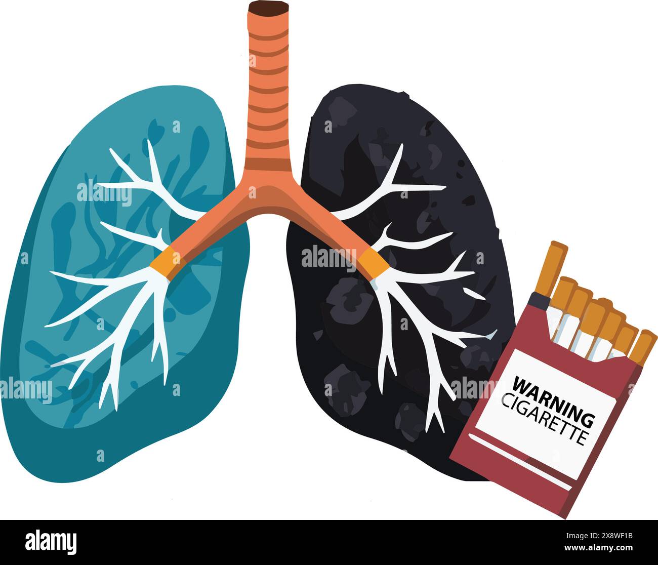 Mit Zigarette infizierte Lungen. Krebserkrankungen durch Rauchen. Rauchen Sie hier nicht. World No Tobacco Day, No Vaping Concept. Stock Vektor