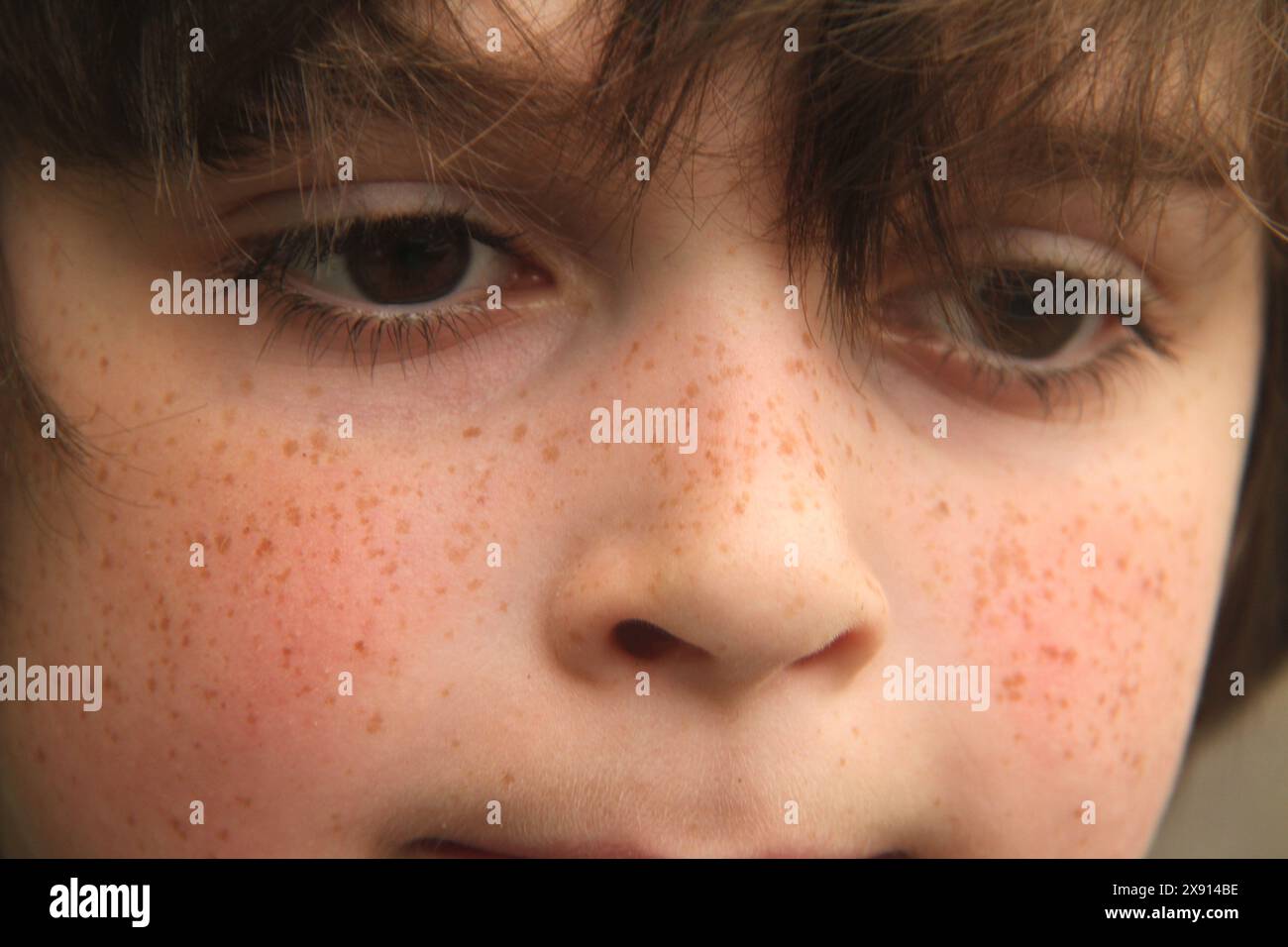 Porträt eines Jungen mit Sommersprossen Stockfoto