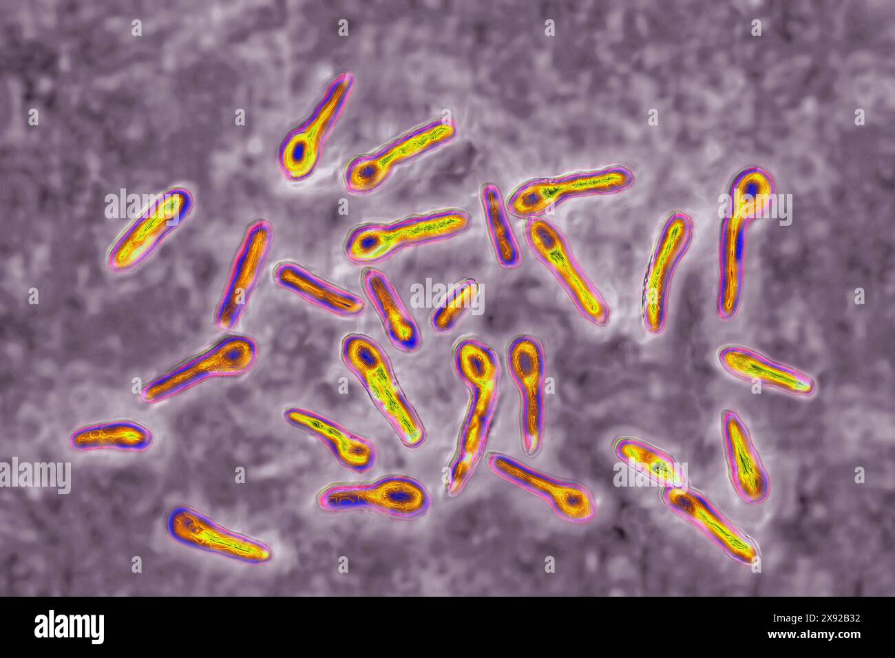 Clostridium tetani oder NicolaÃer-Bazillus ist das Bakterium, das für Tetanus verantwortlich ist. Schon eine minimale Kontamination in einer Wunde führt zur Bildung eines neurotropen Toxins, Tetanospasmin, das an das zentrale Nervensystem bindet und Kontrakturen und Lähmungen verursacht. Bild aus optischer Mikroskopie. Tetanus-Bazillus 016813 057 Stockfoto