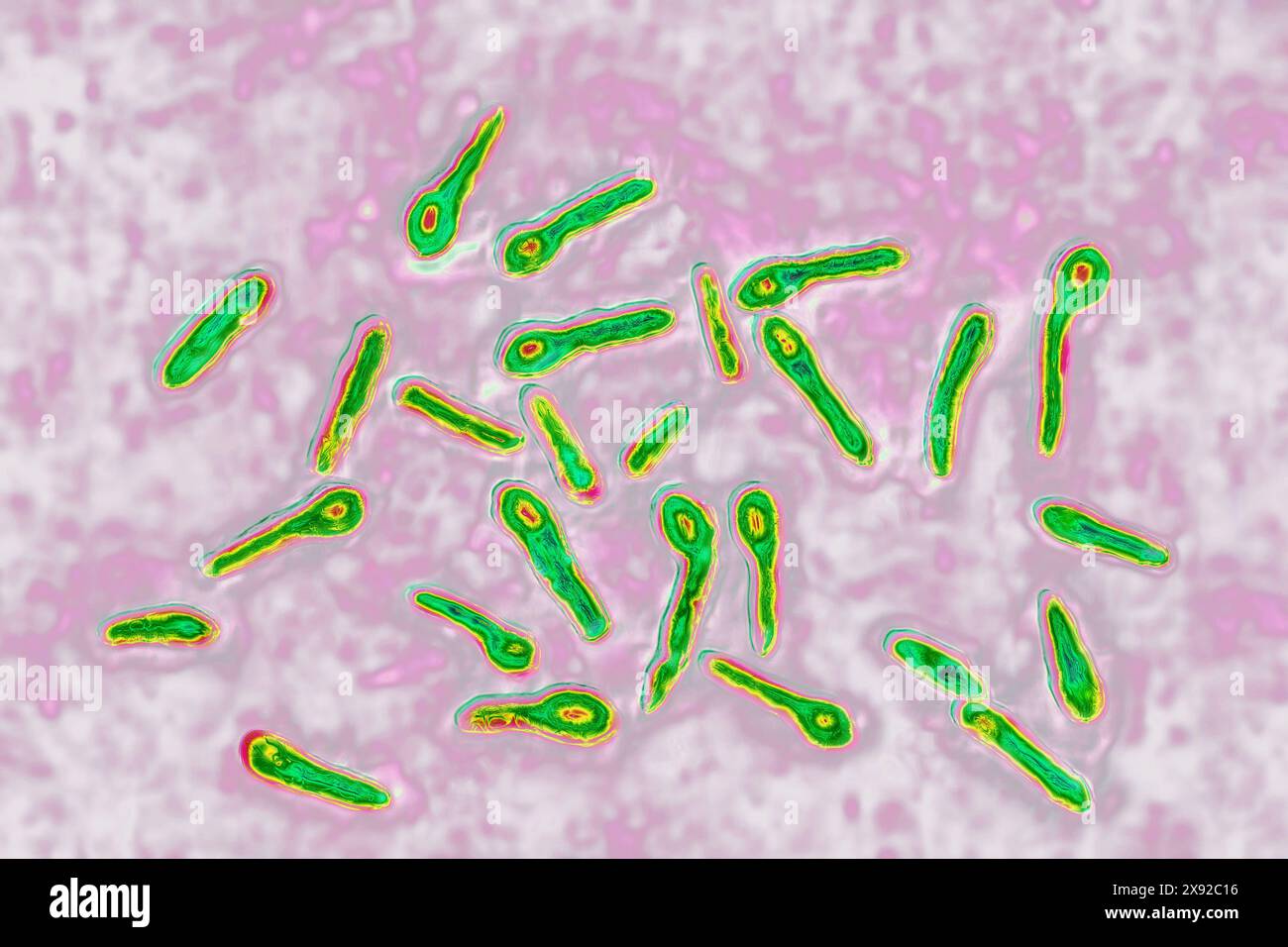 Clostridium tetani oder NicolaÃer-Bazillus ist das Bakterium, das für Tetanus verantwortlich ist. Schon eine minimale Kontamination in einer Wunde führt zur Bildung eines neurotropen Toxins, Tetanospasmin, das an das zentrale Nervensystem bindet und Kontrakturen und Lähmungen verursacht. Bild aus optischer Mikroskopie. Tetanus-Bazillus 016813 058 Stockfoto