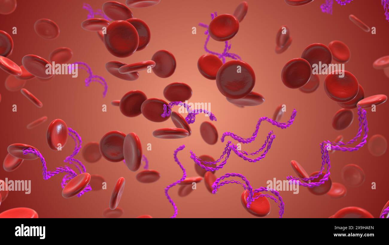 Lyme-Borreliose beeinflußt rote Blutkörperchen Stockfoto