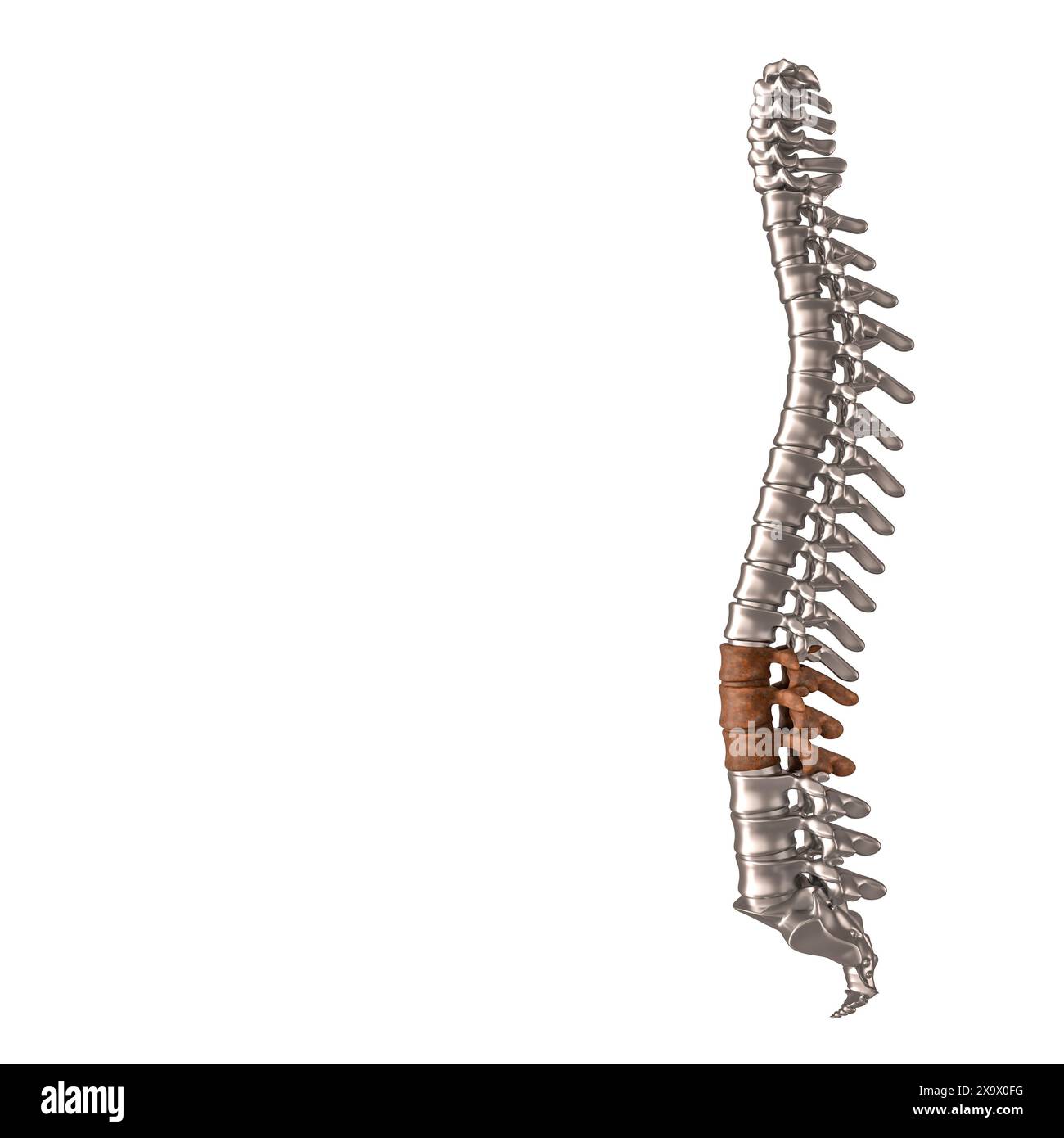 Metallische Wirbelsäule, die Schmerzen im unteren Rücken hervorhebt, isolierter weißer Hintergrund Stockfoto