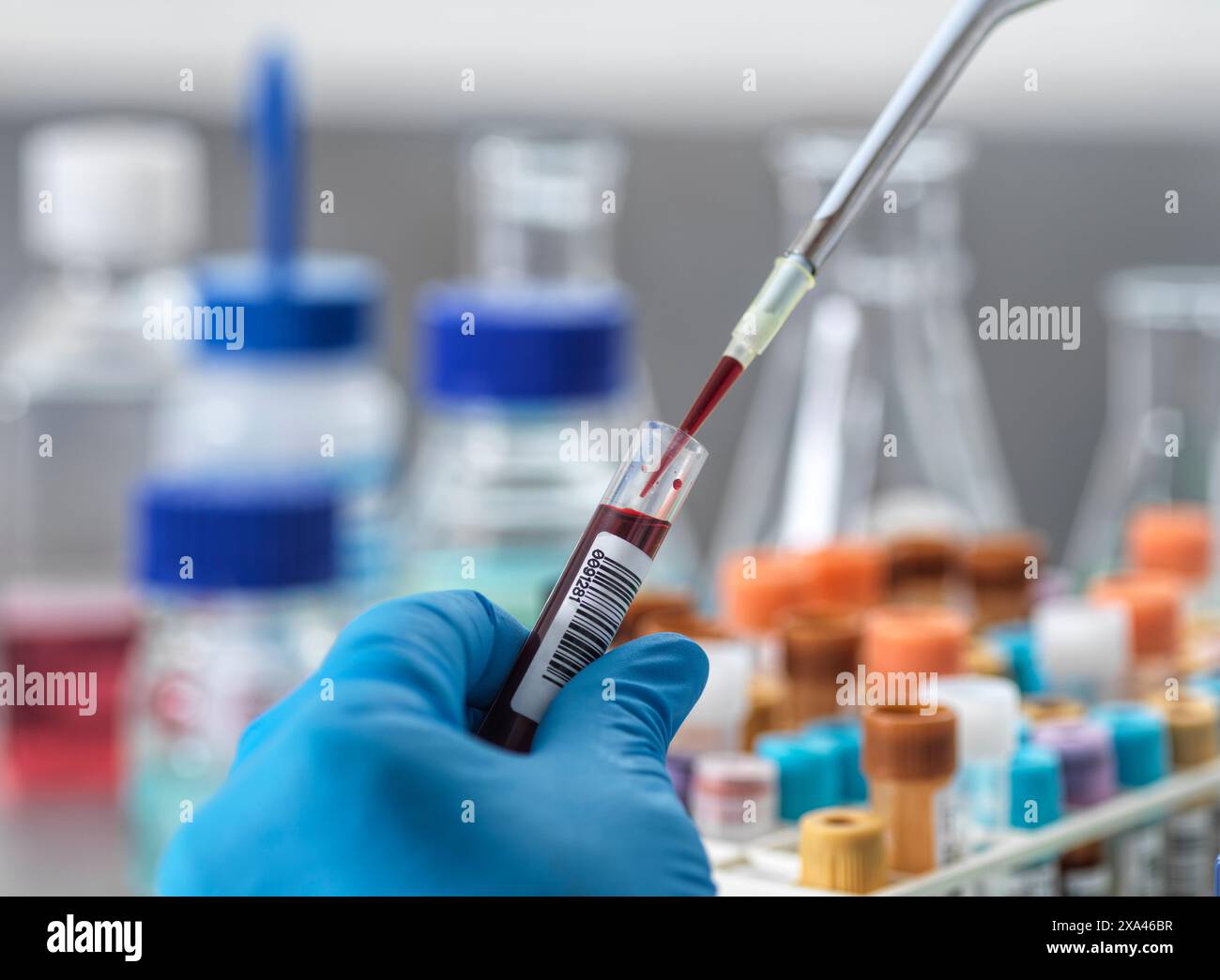 Labortechniker pipettieren der Blutprobe zur Analyse. Stockfoto