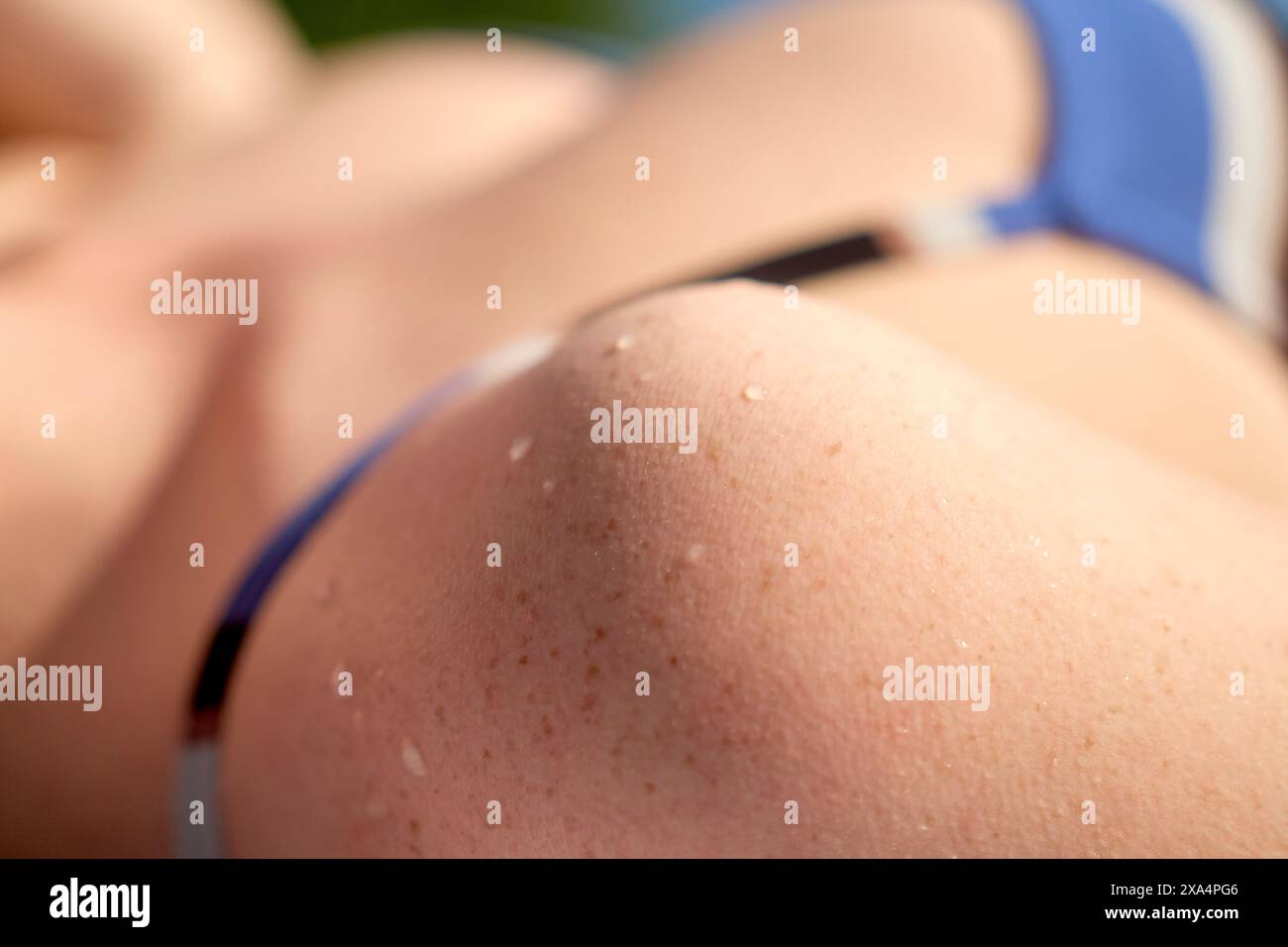 Nahaufnahme einer jungen Frau Schulter und Oberarm mit Wassertropfen auf der Haut, in blau-weißem Gewand. Stockfoto