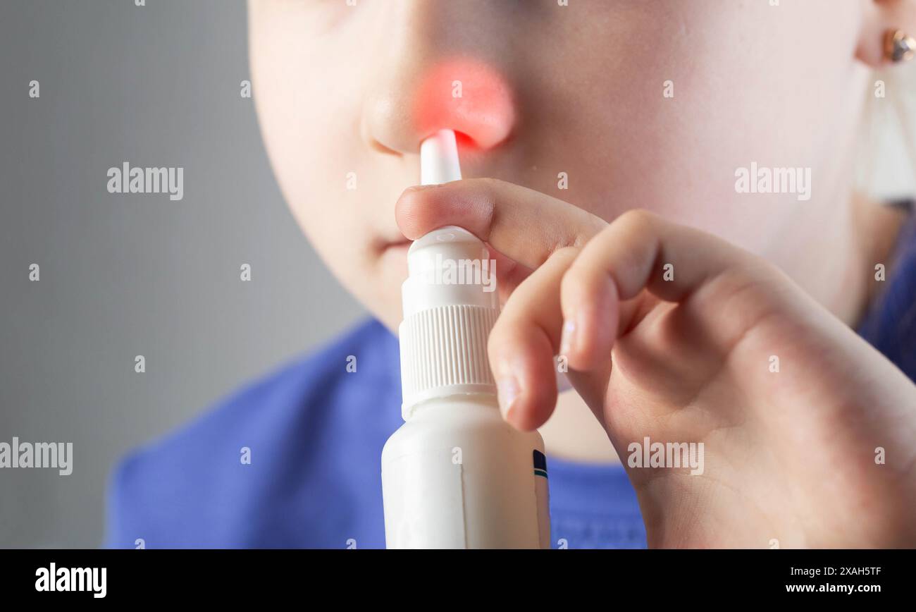 Ein Mädchen sprüht sich ein Spray in die Nase, um allergische Rhinitis zu behandeln. Die Behandlung der laufenden Nase und der Nasenstauung mit medizinischen Sprays. Stockfoto