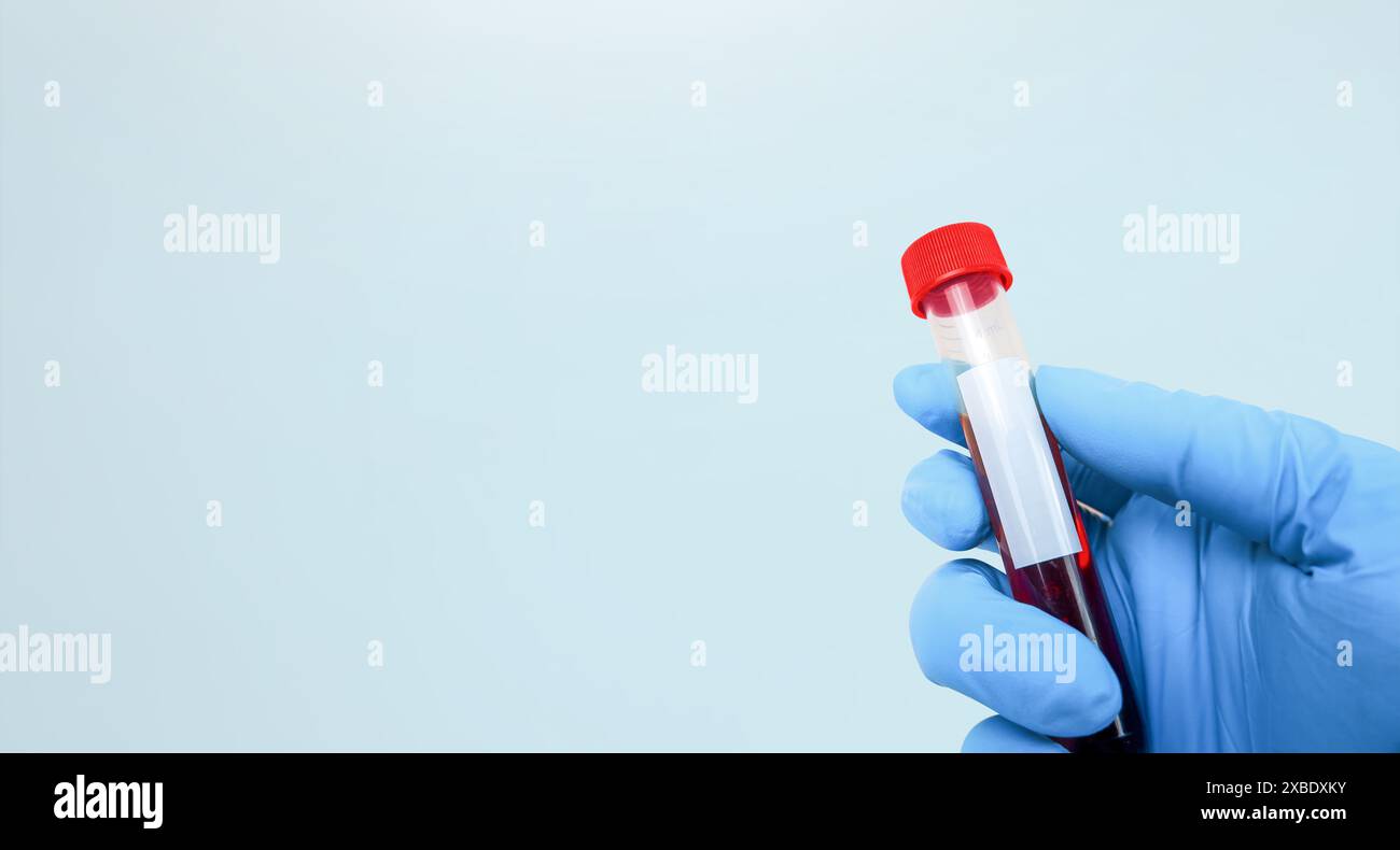 Blutprobe in einem Reagenzglas, das ein Arzt hält, horizontales Banner mit Kopierraum , Gesundheit und medizinisches Konzept Stockfoto