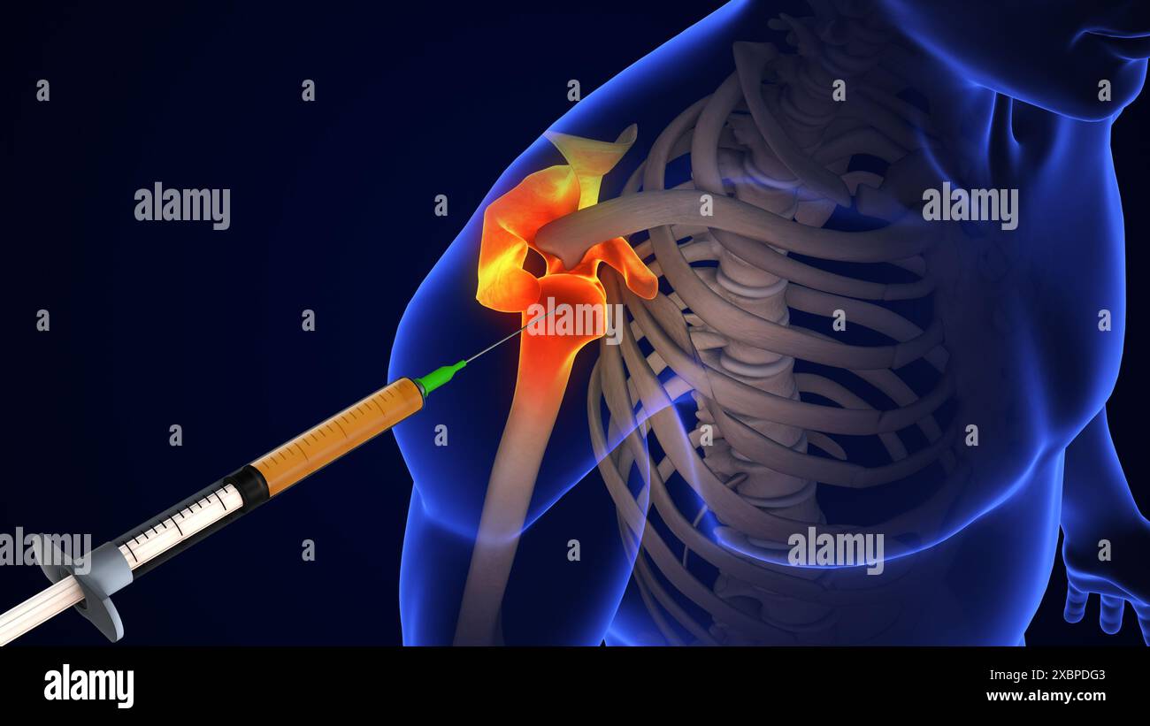 Anatomie Der Menschlichen Schultergelenkbehandlung Stockfoto