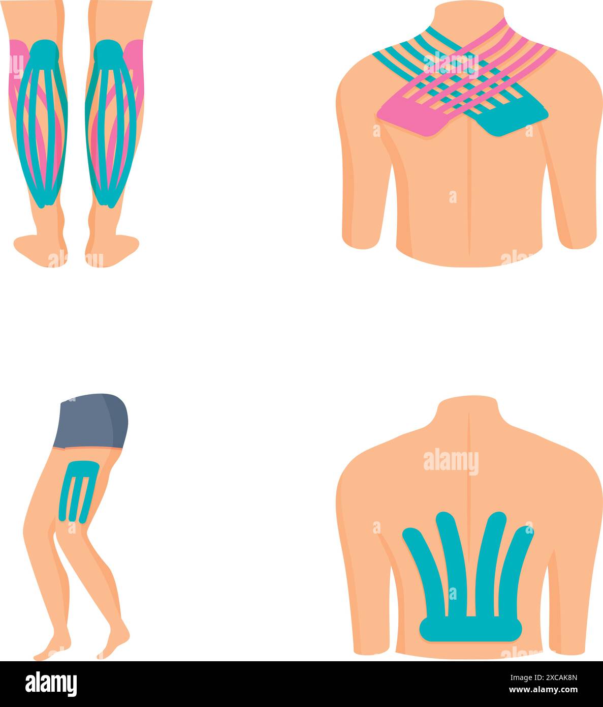 Detaillierte Darstellungen menschlicher Muskelschmerzen zur Aufklärung und Sensibilisierung für die Anatomie und Physiologie des Muskelsystems Stock Vektor