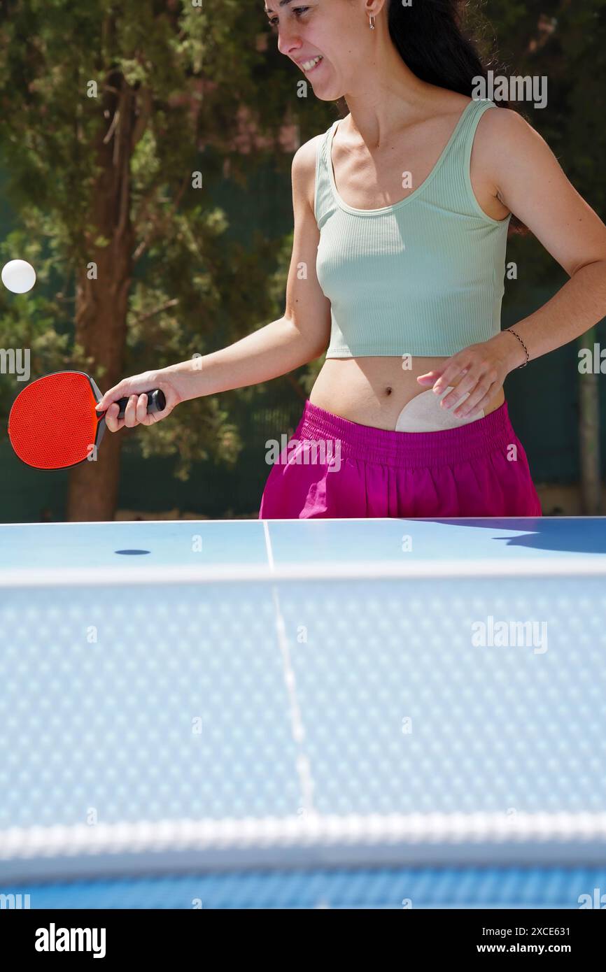 Sportliche Frau, die Sport mit Stomatasche macht. Darmkrebsversorgung Stockfoto