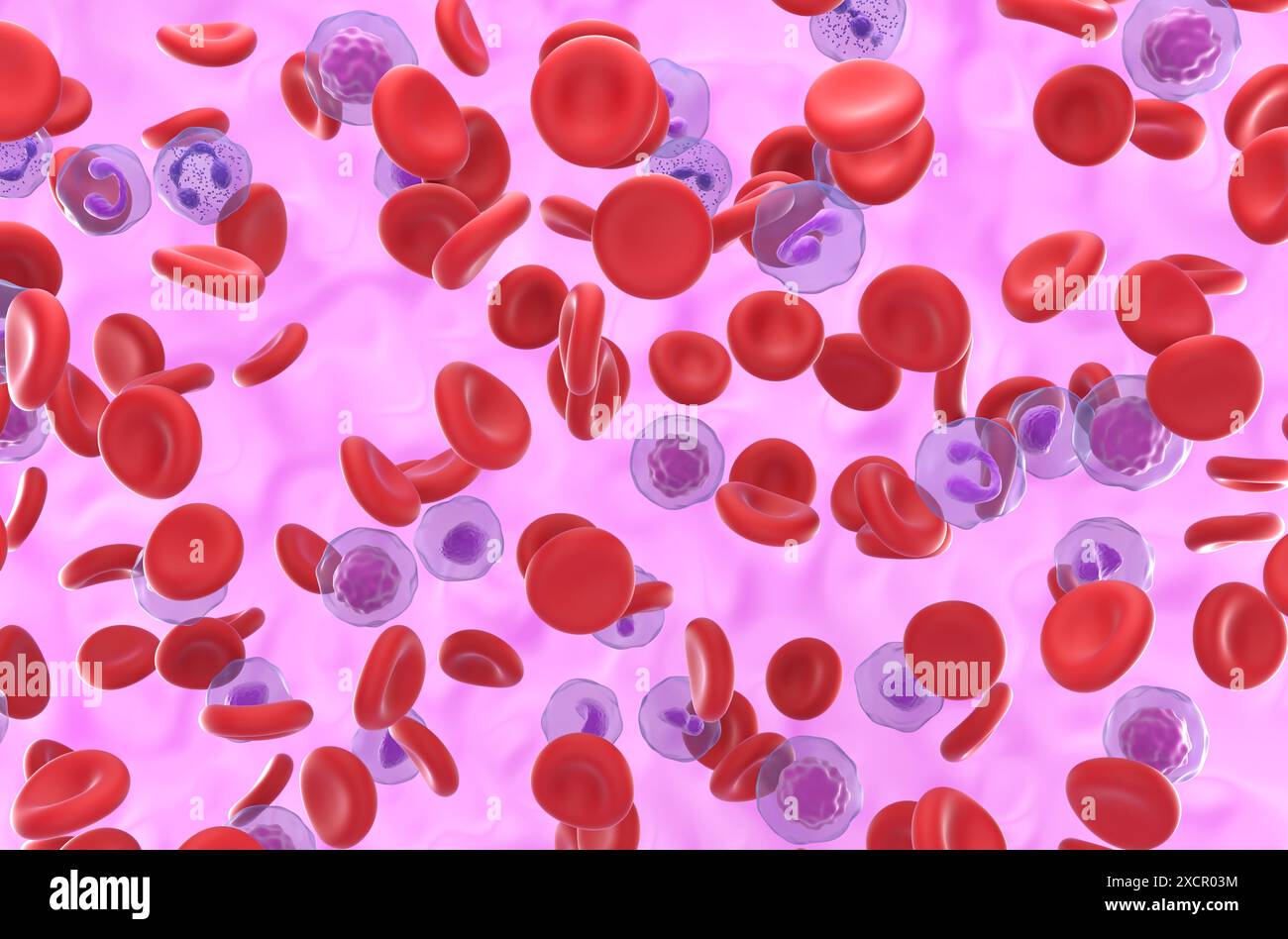 Hohe Anzahl roter Blutkörperchen bei Polycythaemia vera (PV) – isometrische 3D-Darstellung Stockfoto