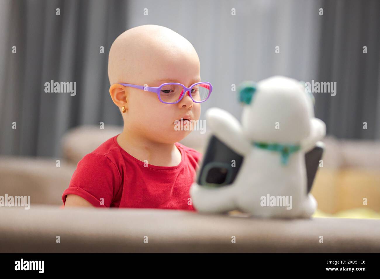 Mädchen mit Haarausfall durch Chemotherapie. Internationaler Tag Des Krebses Im Kindesalter Stockfoto