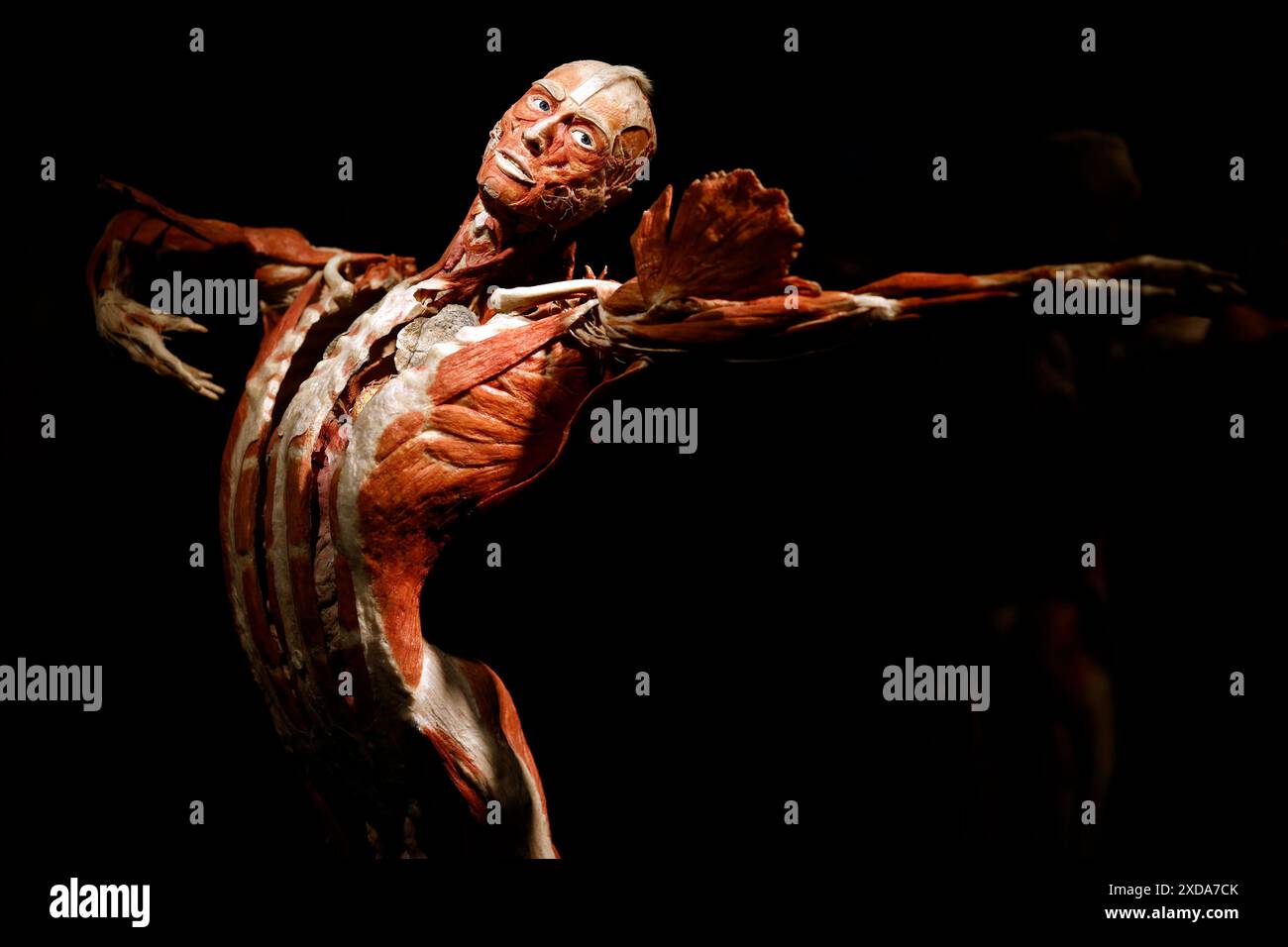 Impression aus der Anatomie-Ausstellung KÖRPERWELTEN & der Zyklus des Lebens von Wissenschaftler Dr. Gunther von Hagens und Kuratorin Dr. Angelina Whalley in der Oskar-Jäger-Straße 99. Achtung: Zugelassen für rein redaktionelle Nutzung. Keine Nutzung der Bilder als Buchillustrationen, Werbemaßnahmen oder in anderen nicht-journalistischen Formaten Köln, 21.06.2024 NRW Deutschland *** Eindruck aus der Anatomieausstellung KÖRPERWELTEN der Zyklus des Lebens von Wissenschaftlerin Dr. Gunther von Hagens und Kuratorin Dr. Angelina Whalley in der Oskar Jäger Straße 99 Aufmerksamkeit nur zur redaktionellen Verwendung zugelassen keine Verwendung o Stockfoto