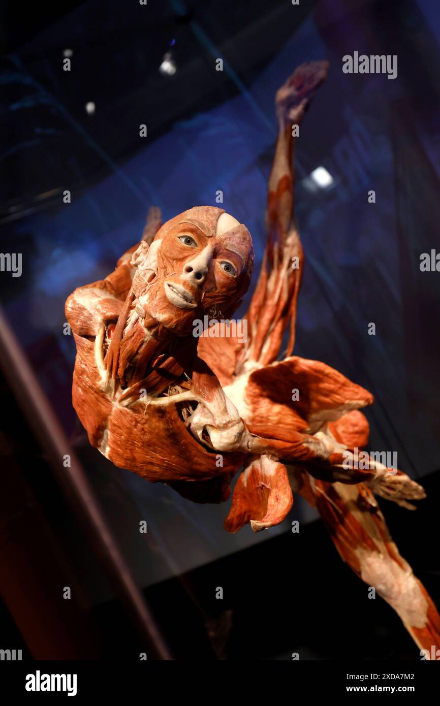 Impression aus der Anatomie-Ausstellung KÖRPERWELTEN & der Zyklus des Lebens von Wissenschaftler Dr. Gunther von Hagens und Kuratorin Dr. Angelina Whalley in der Oskar-Jäger-Straße 99. Achtung: Zugelassen für rein redaktionelle Nutzung. Keine Nutzung der Bilder als Buchillustrationen, Werbemaßnahmen oder in anderen nicht-journalistischen Formaten Köln, 21.06.2024 NRW Deutschland *** Eindruck aus der Anatomieausstellung KÖRPERWELTEN der Zyklus des Lebens von Wissenschaftlerin Dr. Gunther von Hagens und Kuratorin Dr. Angelina Whalley in der Oskar Jäger Straße 99 Aufmerksamkeit nur zur redaktionellen Verwendung zugelassen keine Verwendung o Stockfoto