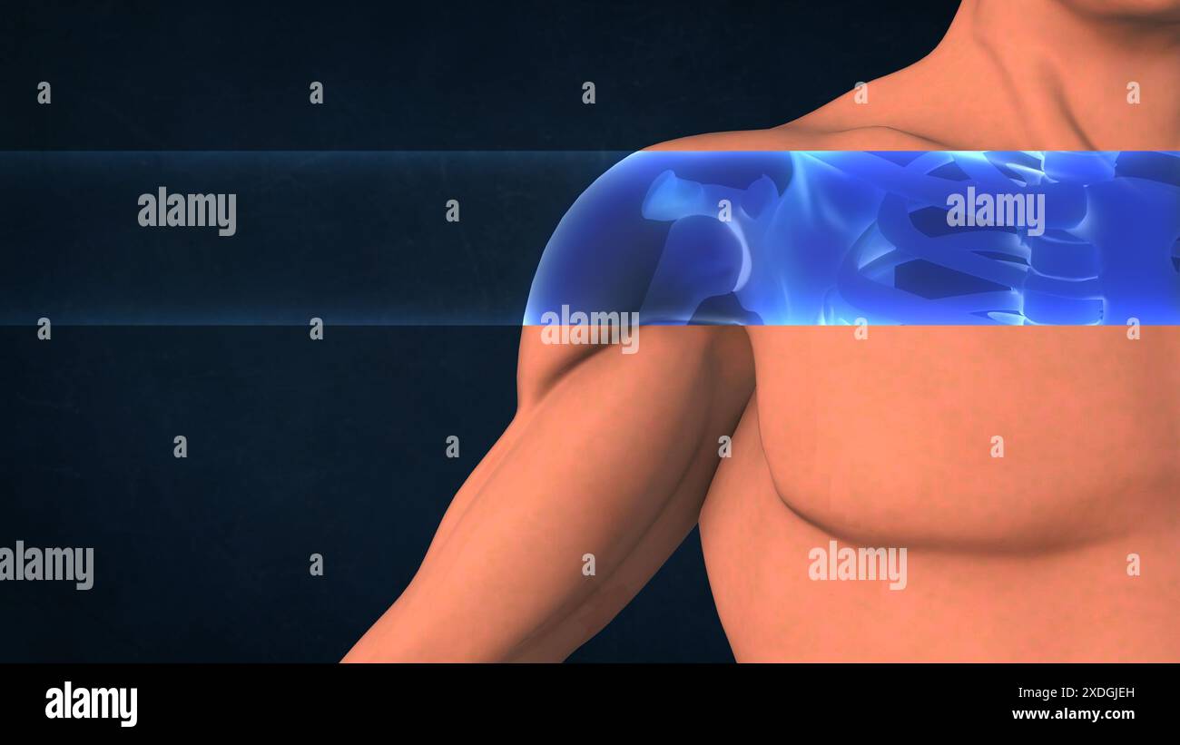 Ein Röntgenbild einer menschlichen Schulter Stockfoto