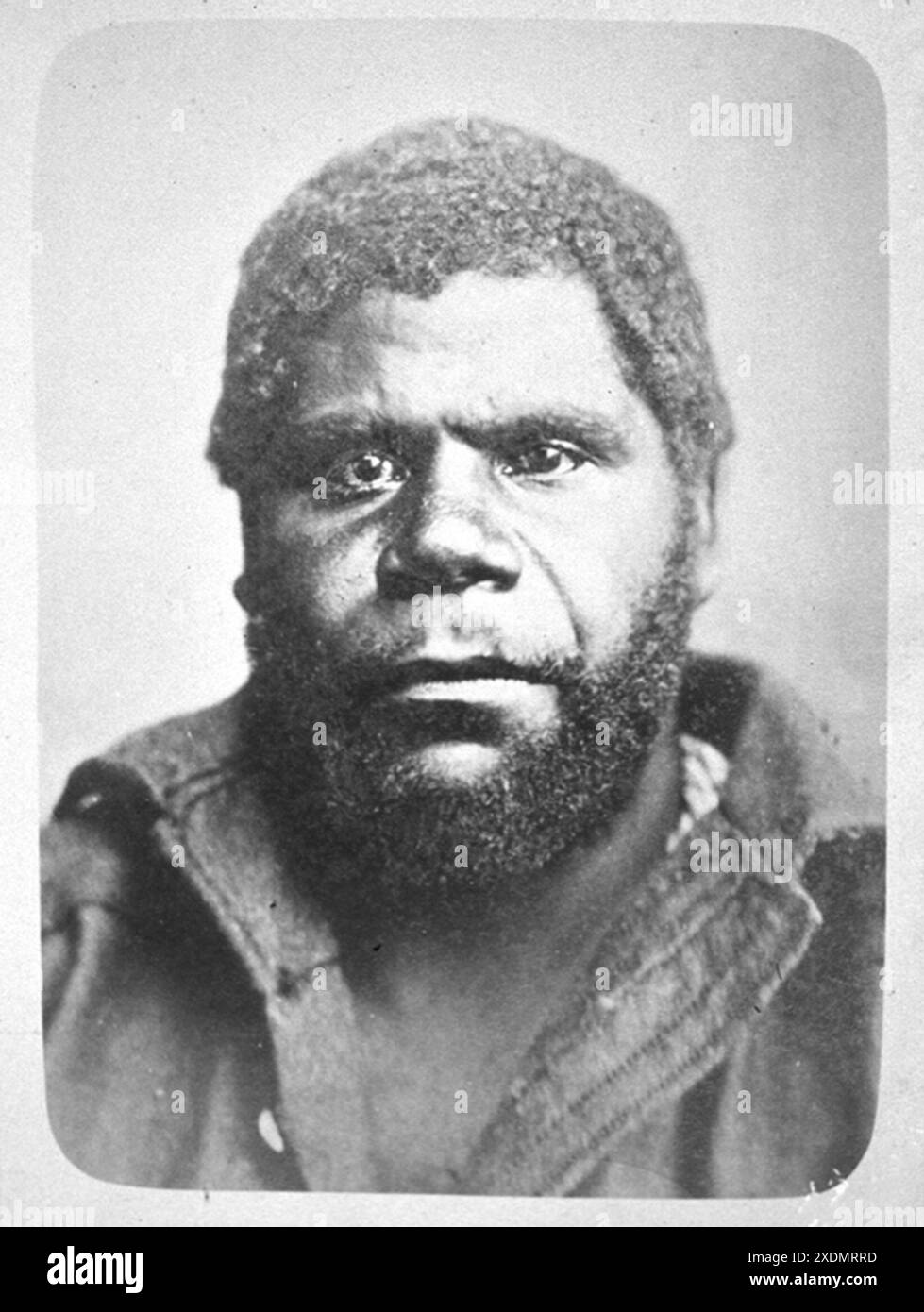 William Lanne (1836–1869), William Lanné und auch bekannt als King Billy oder William Laney, ein tasmanischer Aborigine-Mann, bekannt als der letzte Aborigine-Mann in der Kolonie Tasmanien. Stockfoto