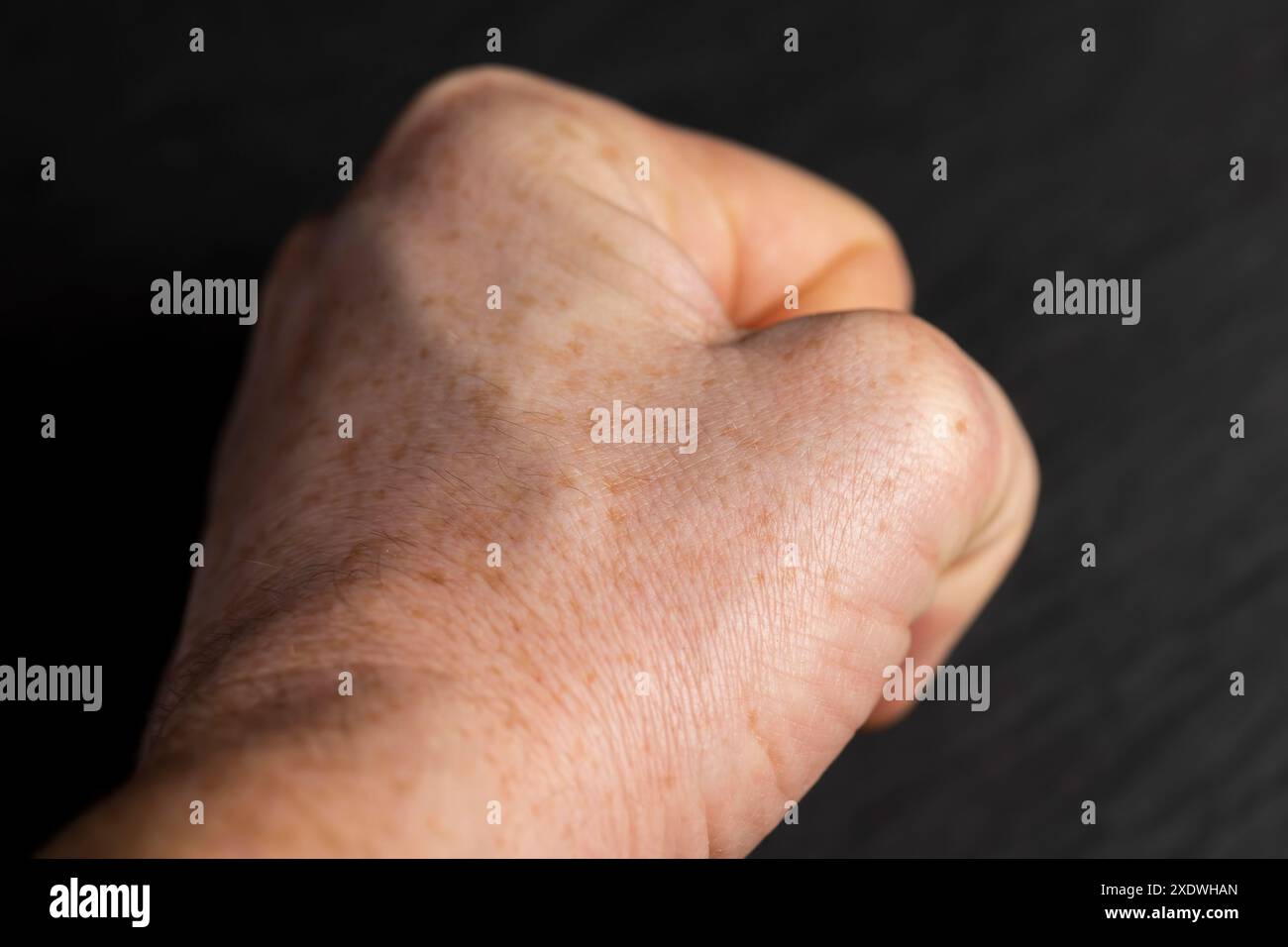 Details der Hand eines Mannes in Nahaufnahme, Teil der Hand eines Mannes mit Sommersprossen Stockfoto
