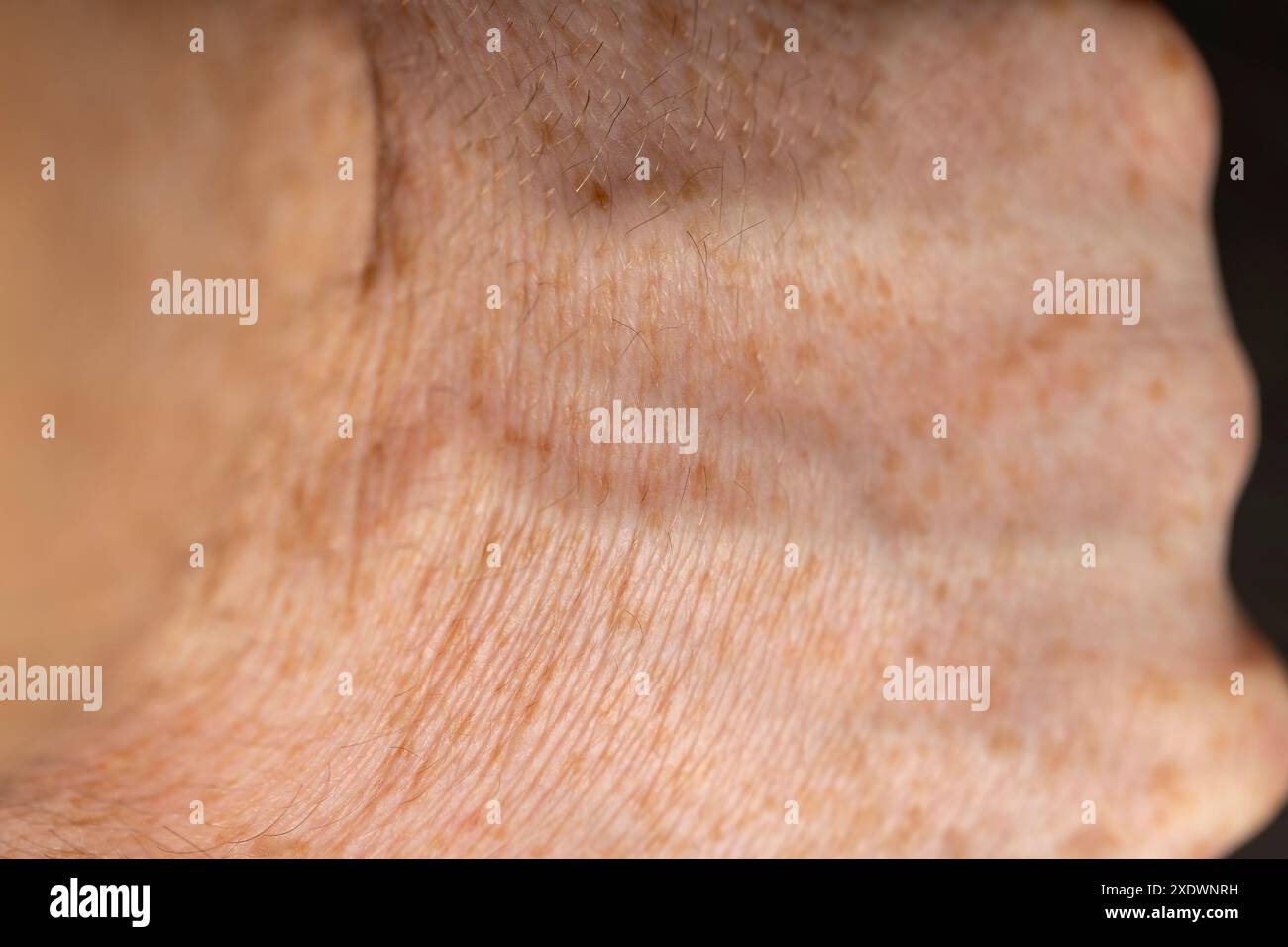 Details der Hand eines Mannes in Nahaufnahme, Teil der Hand eines Mannes mit Sommersprossen Stockfoto