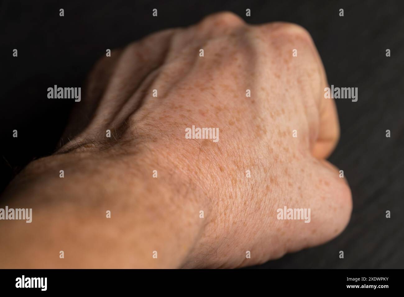 Details der Hand eines Mannes in Nahaufnahme, Teil der Hand eines Mannes mit Sommersprossen Stockfoto