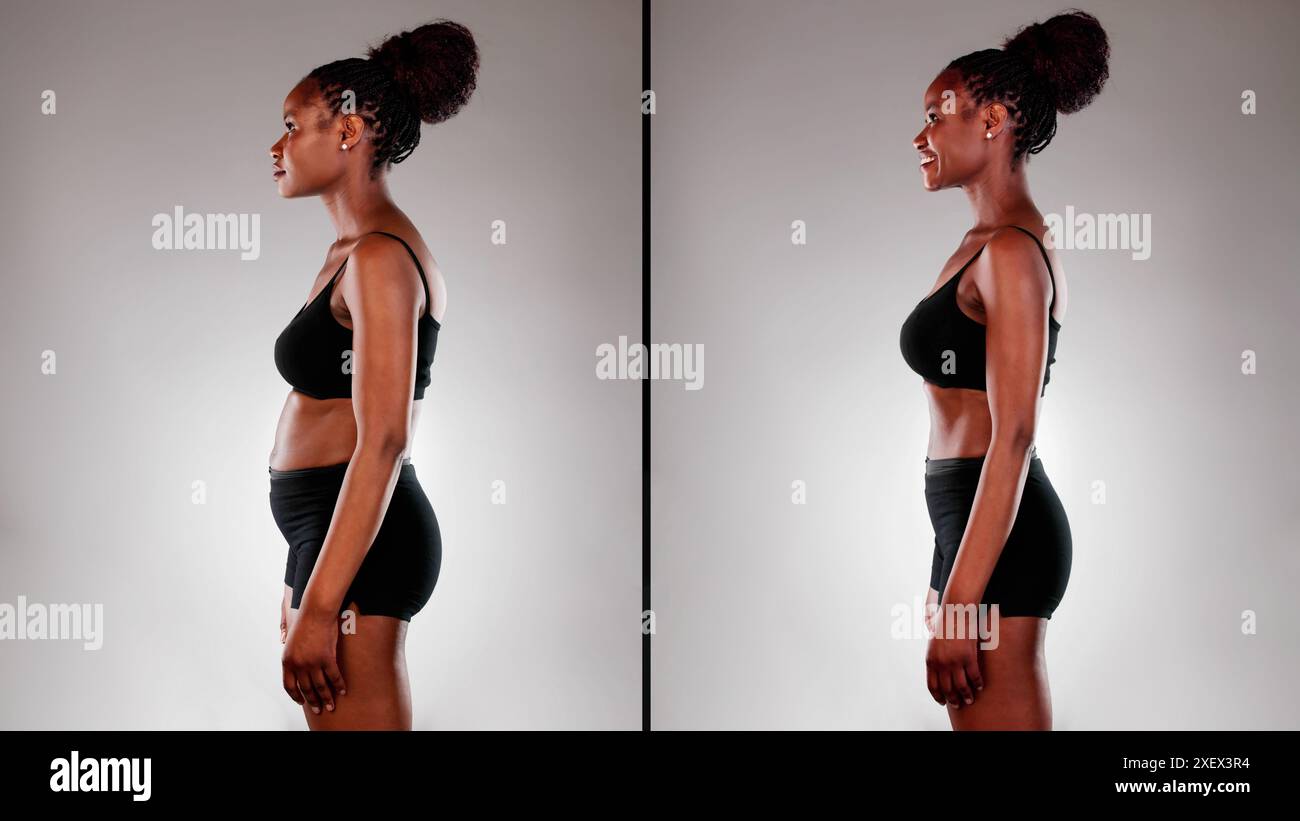 Transformation: Von Adipositas zur Fitness - die inspirierende Gewichtsverlust-Reise der afroamerikanischen Frau und die Erfolgsgeschichte der Abdominoplastik Stockfoto