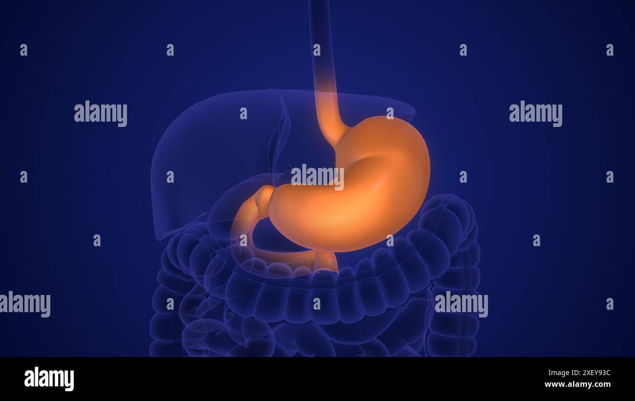 Der Magen wird von Helicobacter pylori Bakterien beeinflusst Stockfoto