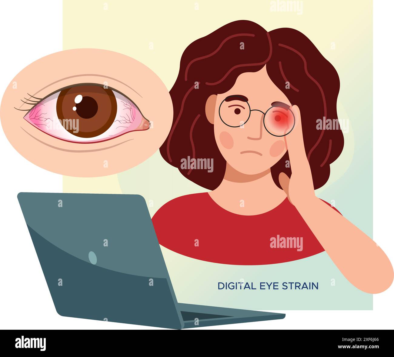 Digital Eye Strain, Person sitzend auf dem Arbeitstisch mit Augenbelastung – Stock Illustration als EPS 10-Datei Stock Vektor