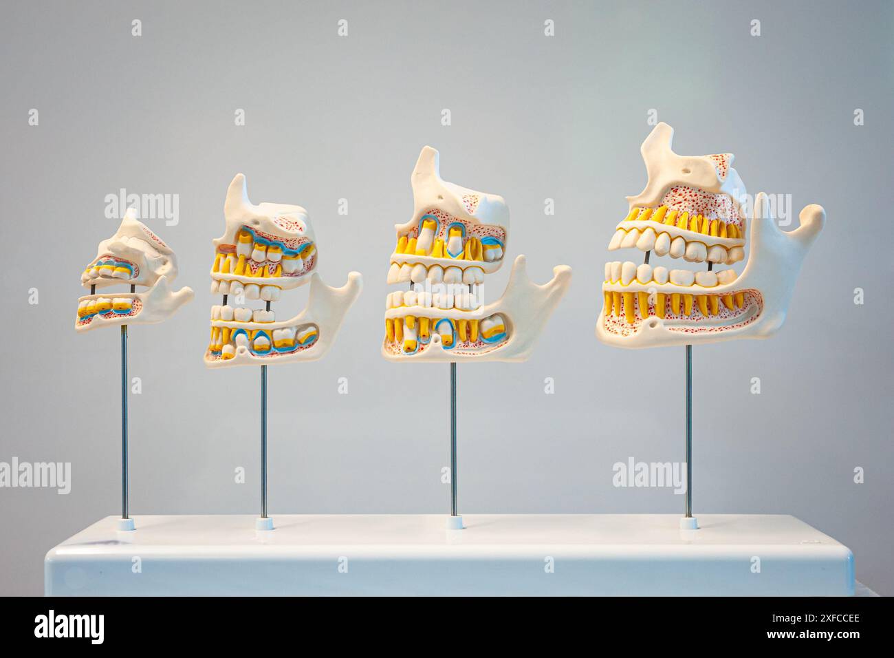 Serie plastischer Dentalmodelle in der Reihenfolge vom frühen Kindesalter bis zum Erwachsenen. Wird im Biologiekurs oder in der Zahnarztpraxis verwendet. Stockfoto