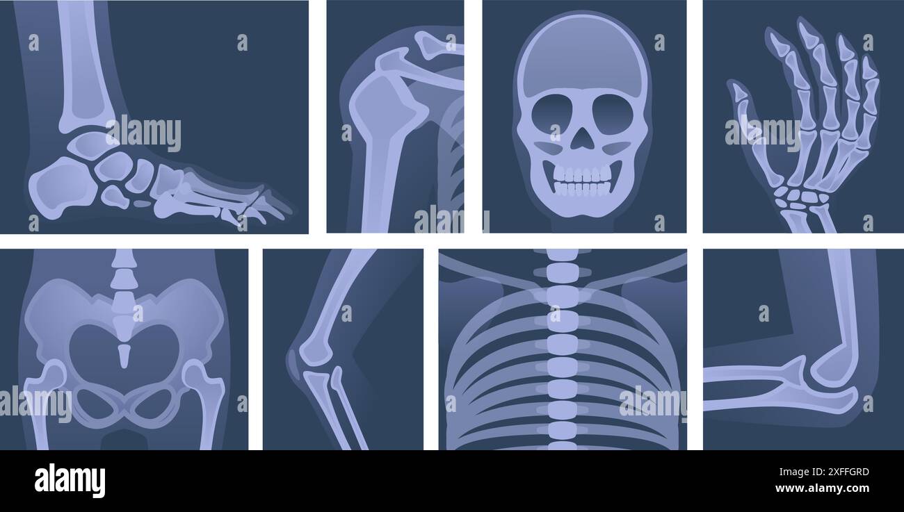 Menschliches Skelett. Röntgenologische Körperteile Schädelknochen von Armen Knie und Beinen exakte Vektormedizin Bildscans Stock Vektor