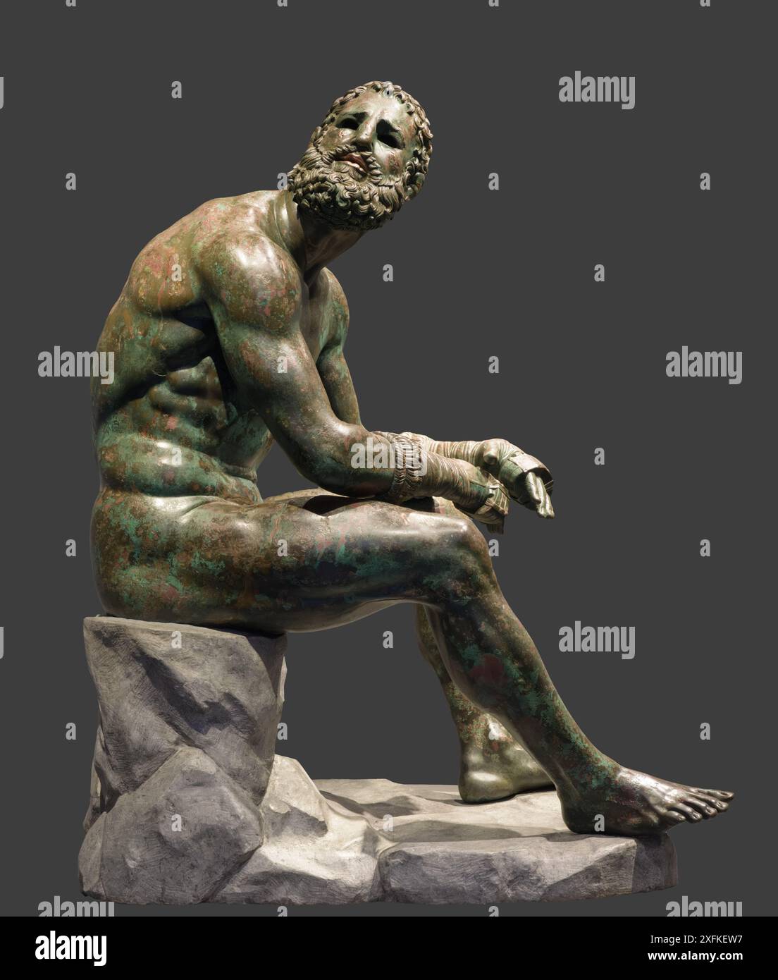 Der Boxer at Rest, auch bekannt als Terme Boxer, Seated Boxer, besiegte Boxer oder Boxer of the Quirinal, ist eine Bronzeskulptur, eine hellenistische griechische o Stockfoto