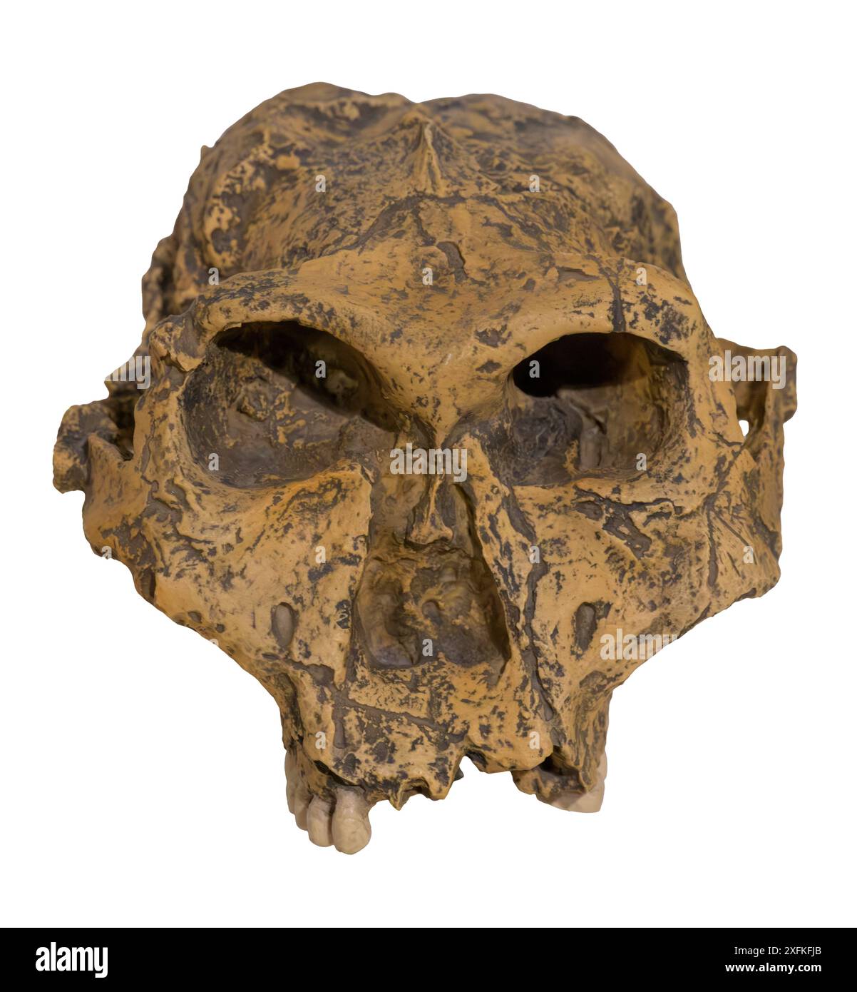 Paranthropus robustus ist eine Art von robustem australopithecin aus dem frühen und möglicherweise mittleren Pleistozän der Wiege der Menschheit, Südafrika Stockfoto