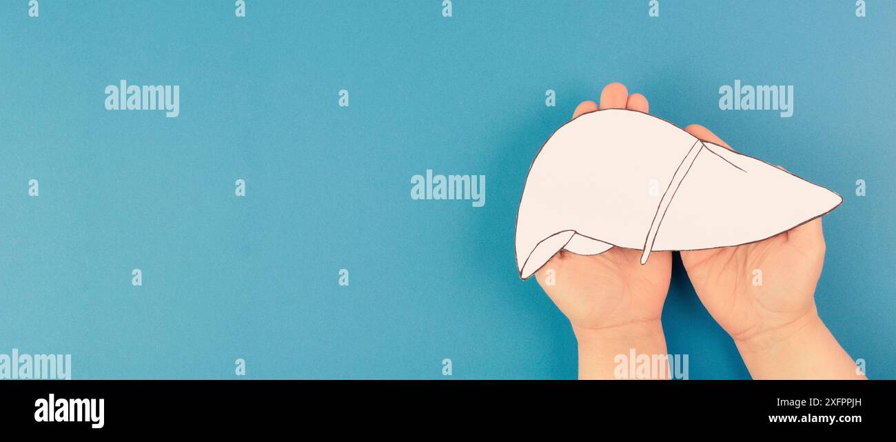 Leberorgan, Welt-Hepatitis-Tag, Diagnose von Krebs, Zirrhose Gesundheitsproblem, alkoholische Fettleber Stockfoto