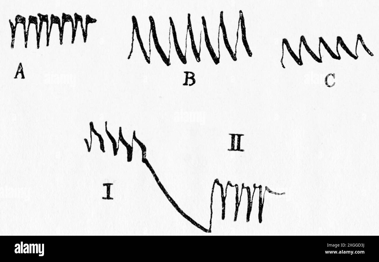 Wissenschaft, Biologie, Erregbarkeit des Nervs (A), einer Pflanze (B) und eines Metalls (C), ADDITIONAL-RIGHTS-CLEARANCE-INFO-NOT-AVAILABLE Stockfoto