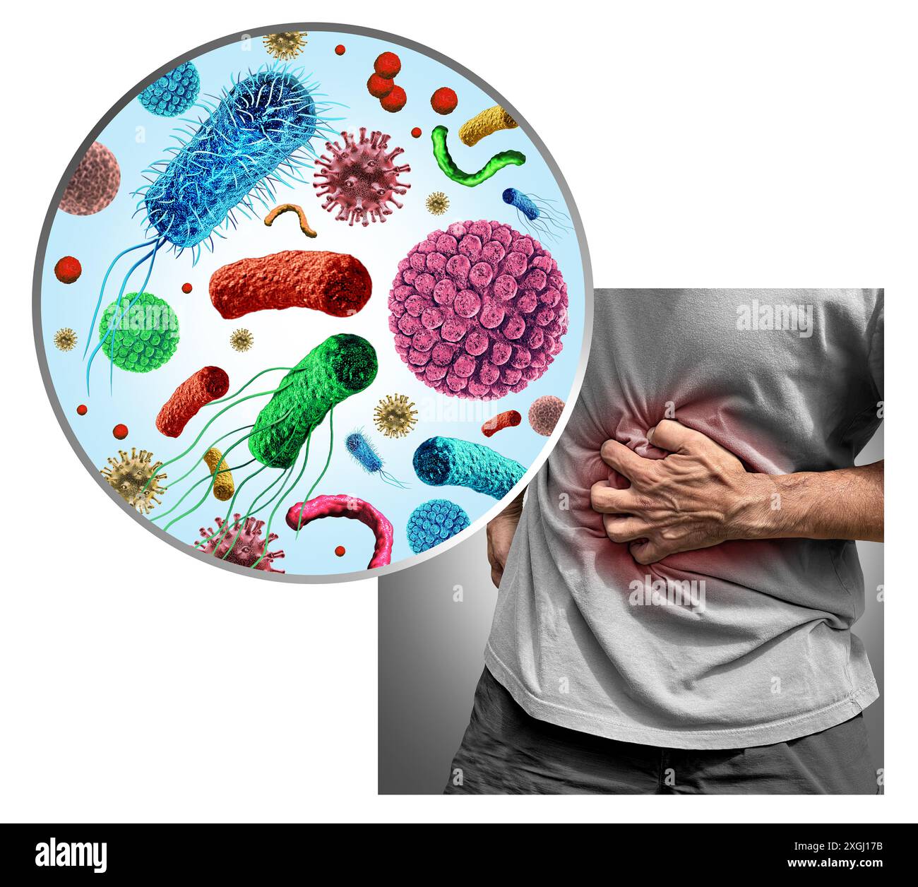 Gastroenteritis oder ansteckende Gastroerkrankung als Magengrippe und Darminfektion. Stockfoto