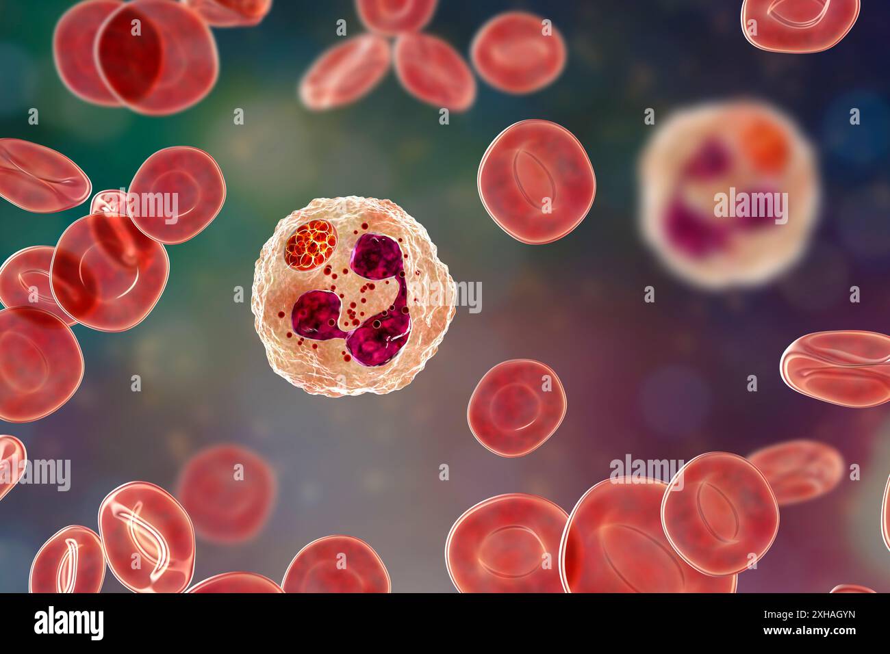 Abbildung: Anaplasma sp. Bakterien, die neutrophile Granulozyten infizieren. Anaplasma phagocytophilum verursacht eine humane granulozytäre Anaplasmose, die von der Schwarzbeinzecke und der Schafzecke übertragen wird. Stockfoto