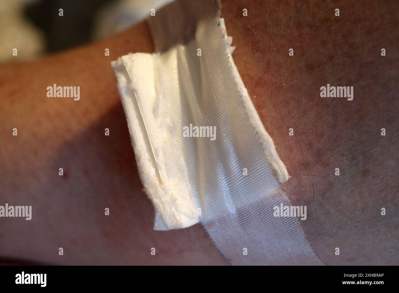 Steriles Mullpad, das nach einer Injektion oder Blutentnahme mit medizinischem Klebeband auf die Haut geklebt wird Stockfoto Steriles Mullpad, das nach einer Injektion oder Blutentnahme mit medizinischem Klebeband auf die Haut geklebt wird Stockfoto