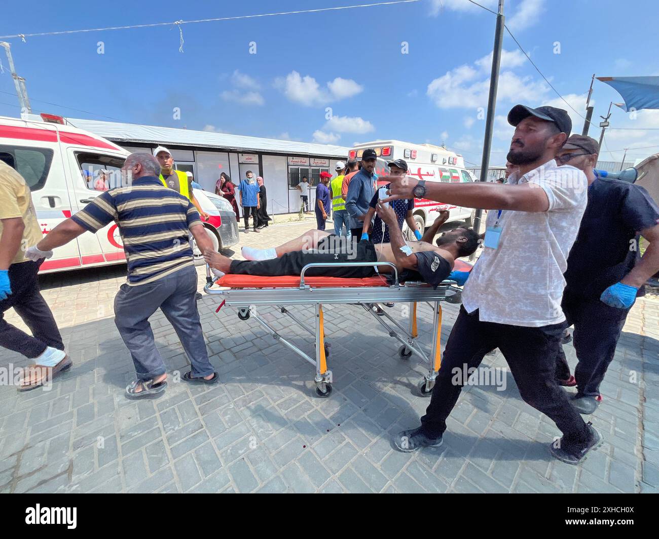 Khan Younis, Gaza. Juli 2024. Verwundete Palästinenser, darunter Kinder und Frauen, werden nach dem israelischen Angriff am Samstag, dem 13. Juli 2024, in Khan Yunis, Gaza, ins Kuwait Field Hospital gebracht, bei dem 71 Menschen getötet wurden. Al-Mawasi wurde von Israel zur Sicherheitszone erklärt, als es seine militärische Offensive in anderen Teilen des Gazastreifens fortsetzt. Foto: Saber Arar/UPI Credit: UPI/Alamy Live News Stockfoto