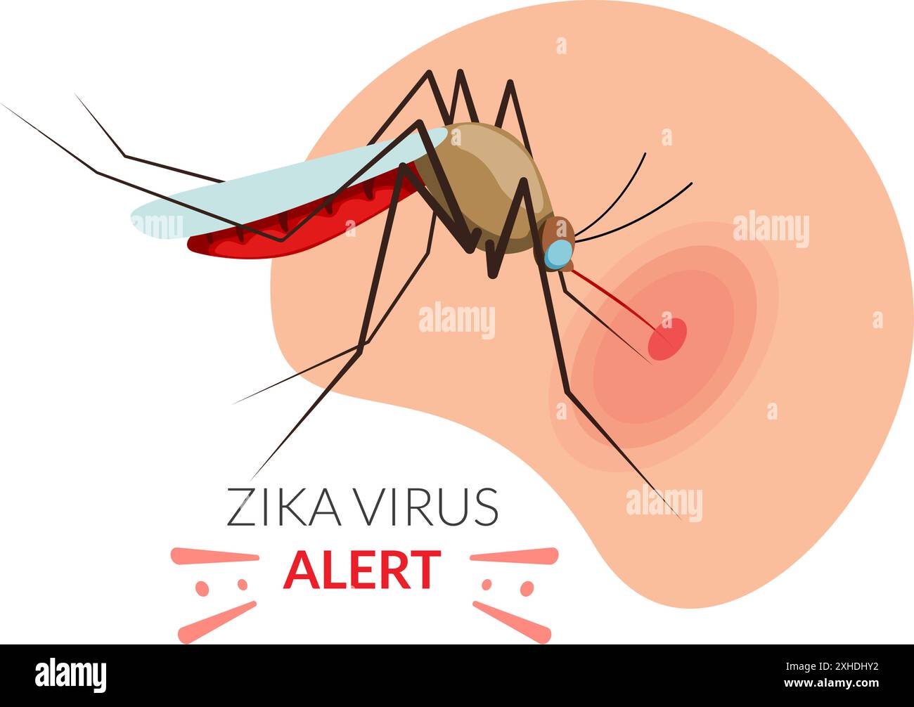 Mückenbeißen auf menschlicher Haut – Zika Alert – Stockillustration als EPS 10 Datei Stock Vektor